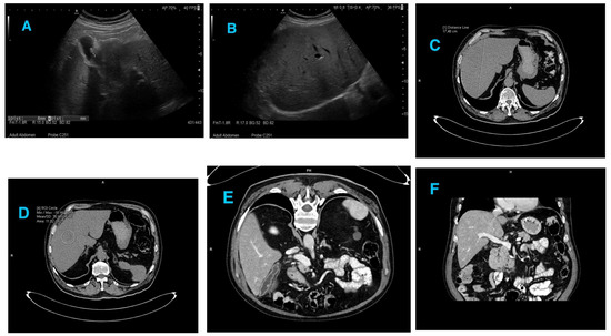 Medicina 58 00896 g0a1 550