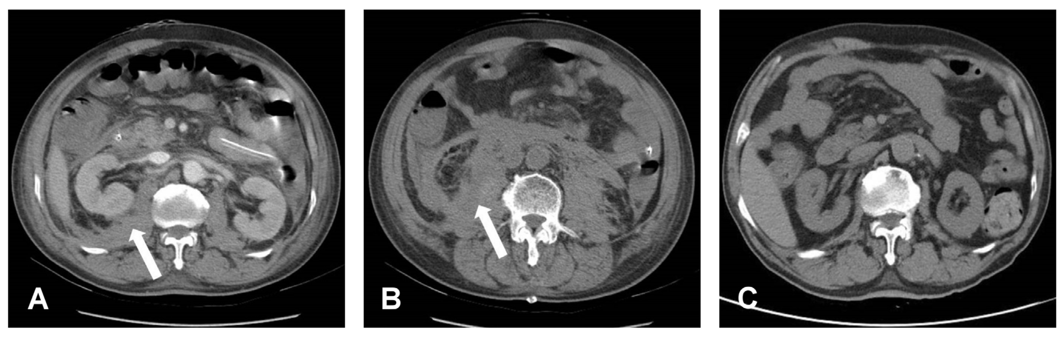 Medicina 58 00927 g003