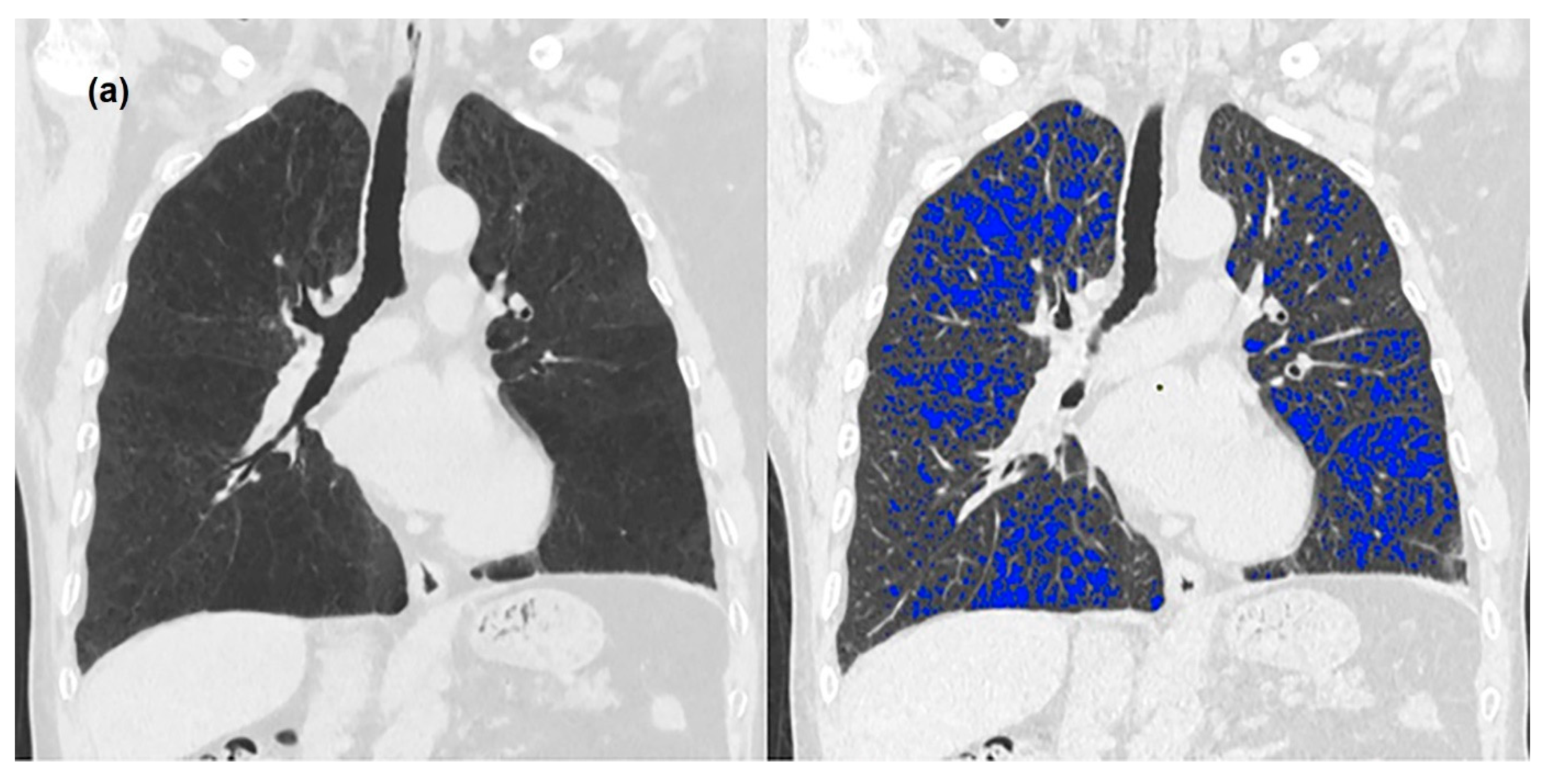 Medicina 58 00939 g001a
