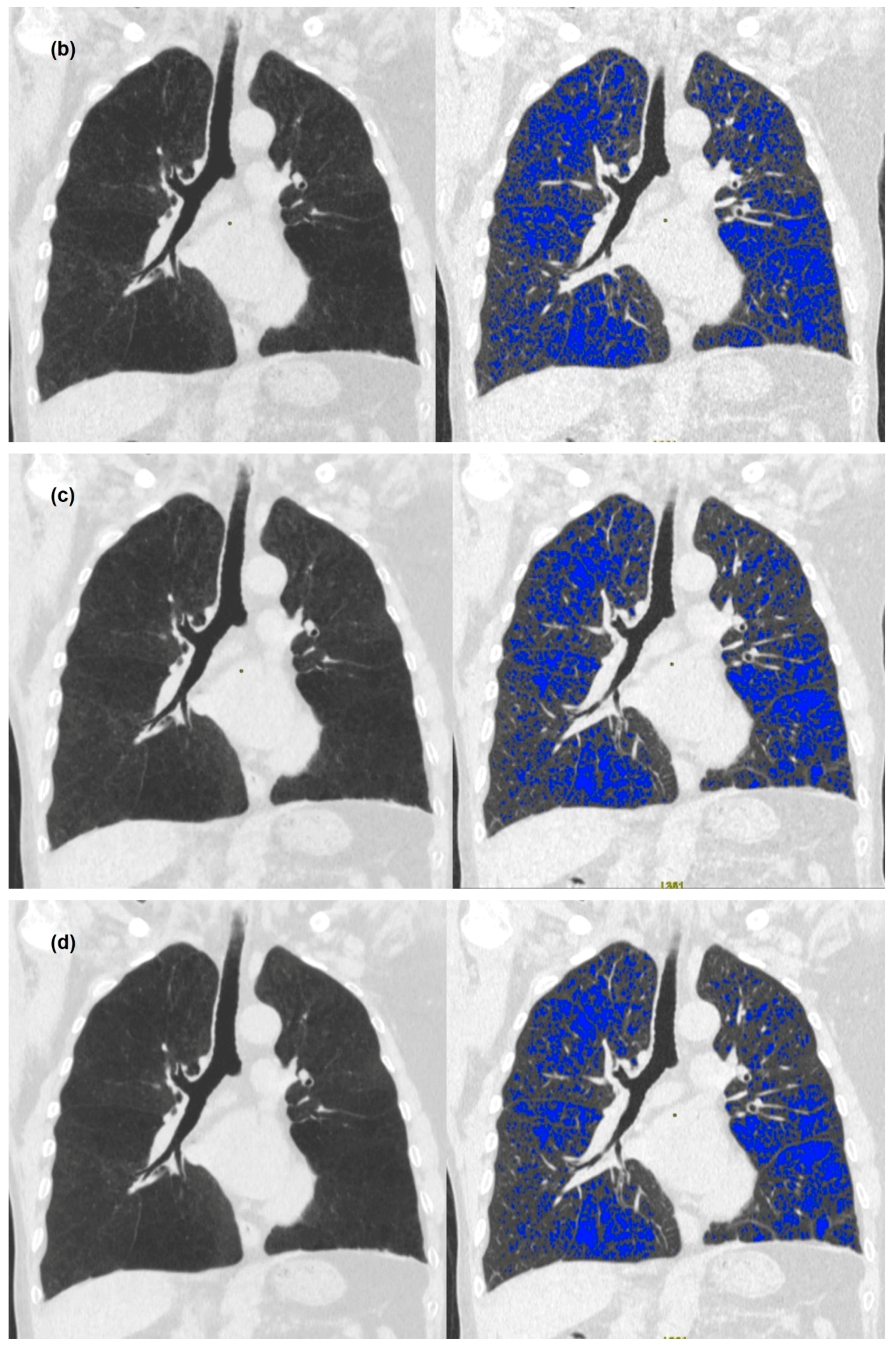 Medicina 58 00939 g001b