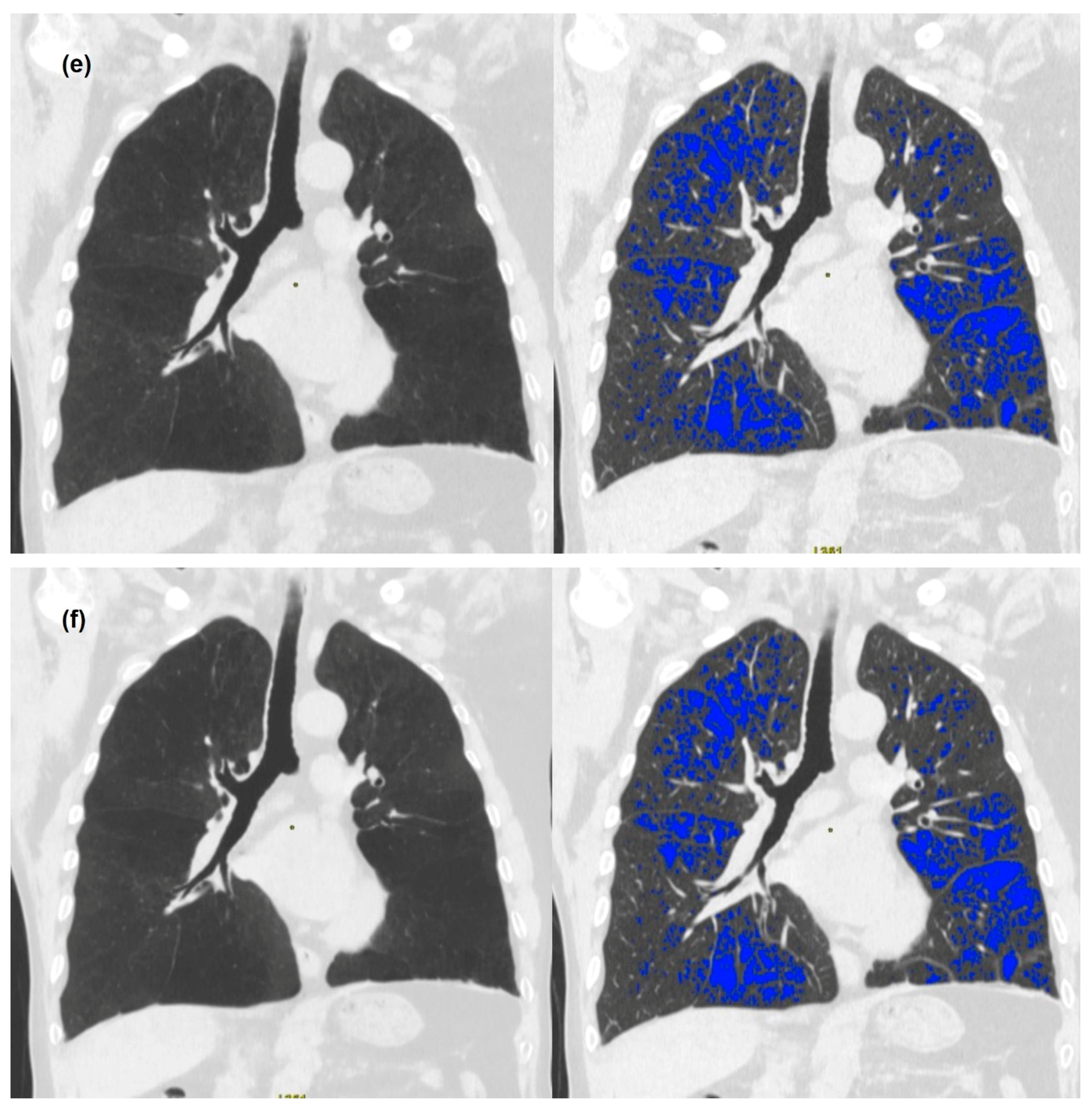 Medicina 58 00939 g001c