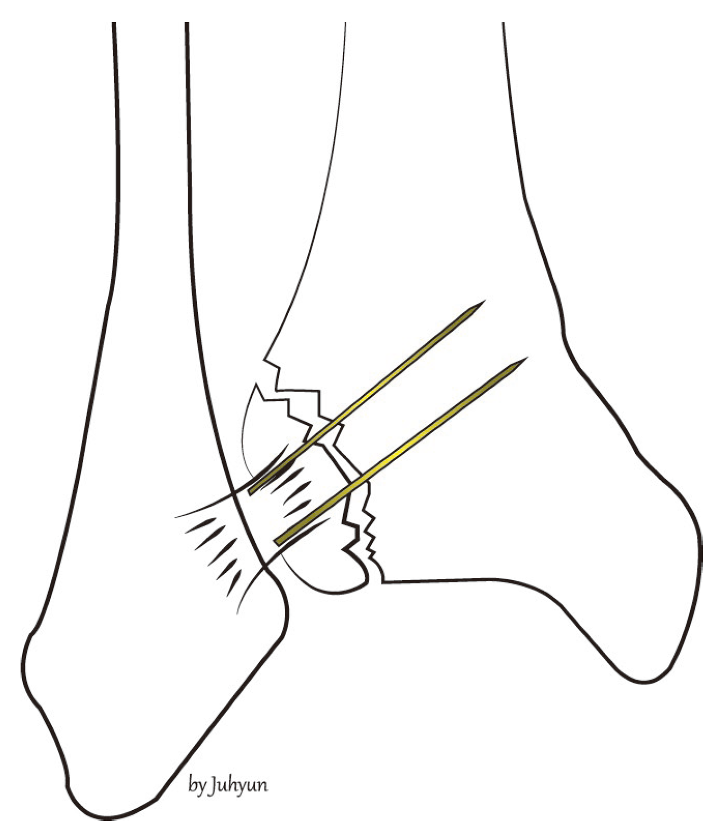 Medicina 58 01005 g002