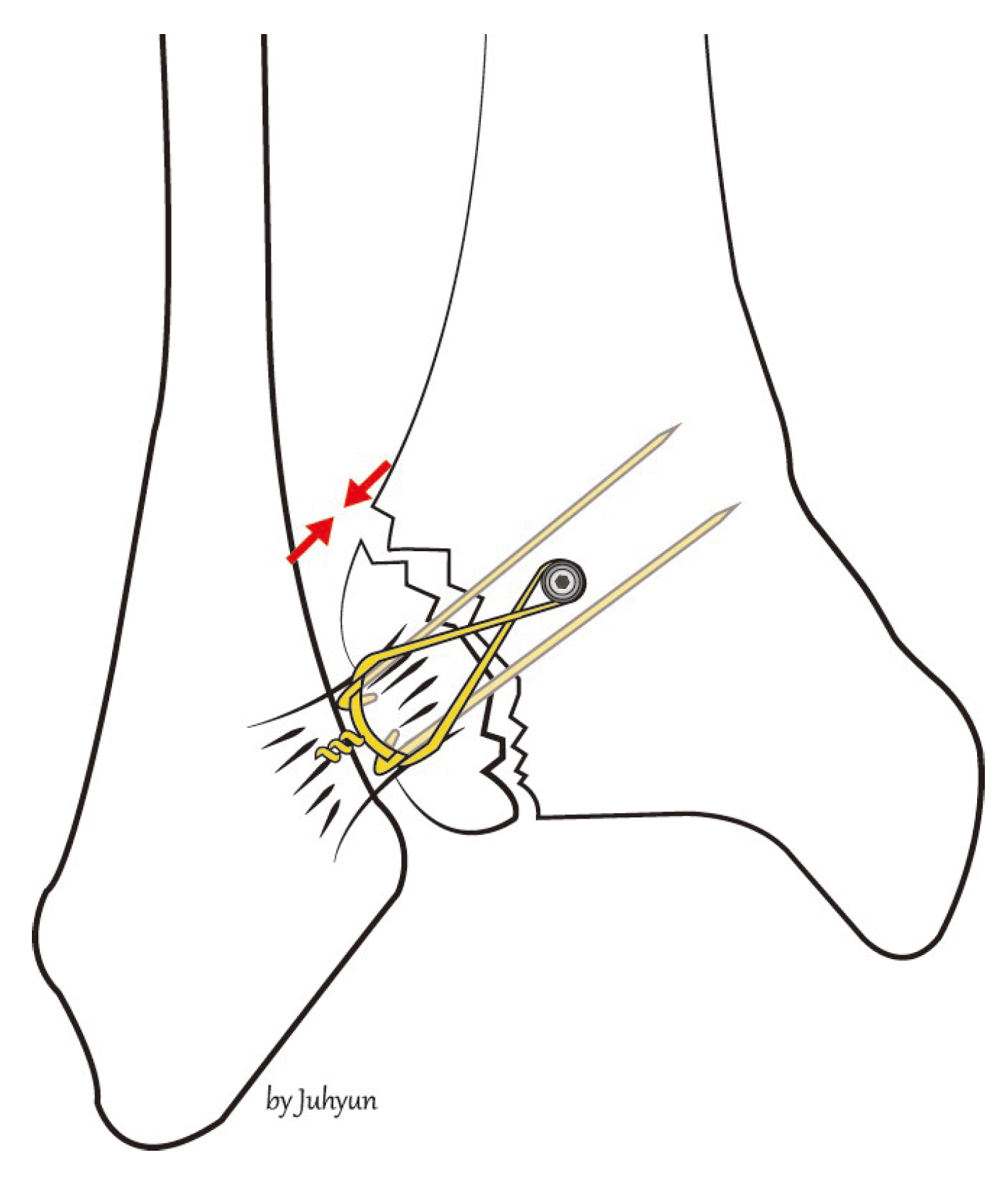Medicina 58 01005 g003