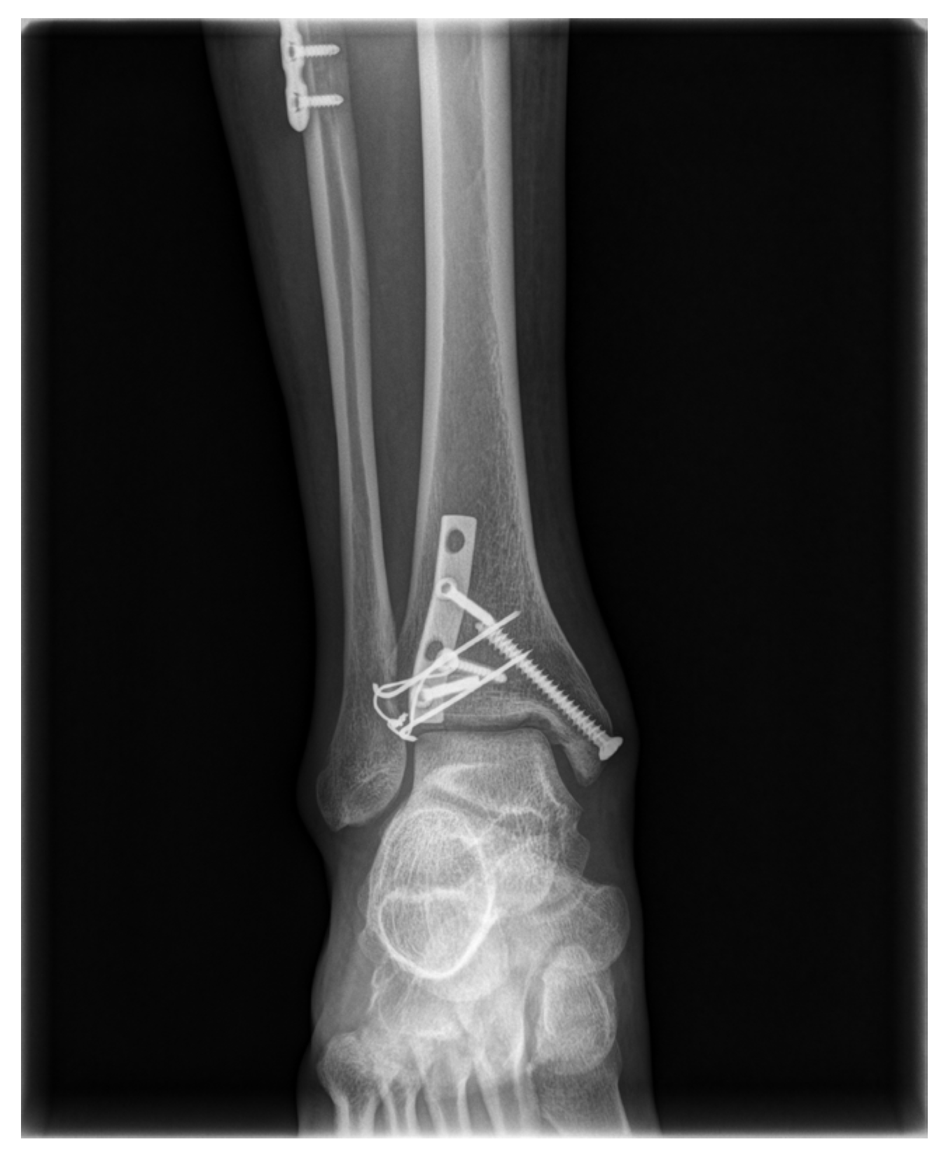 Medicina 58 01005 g004