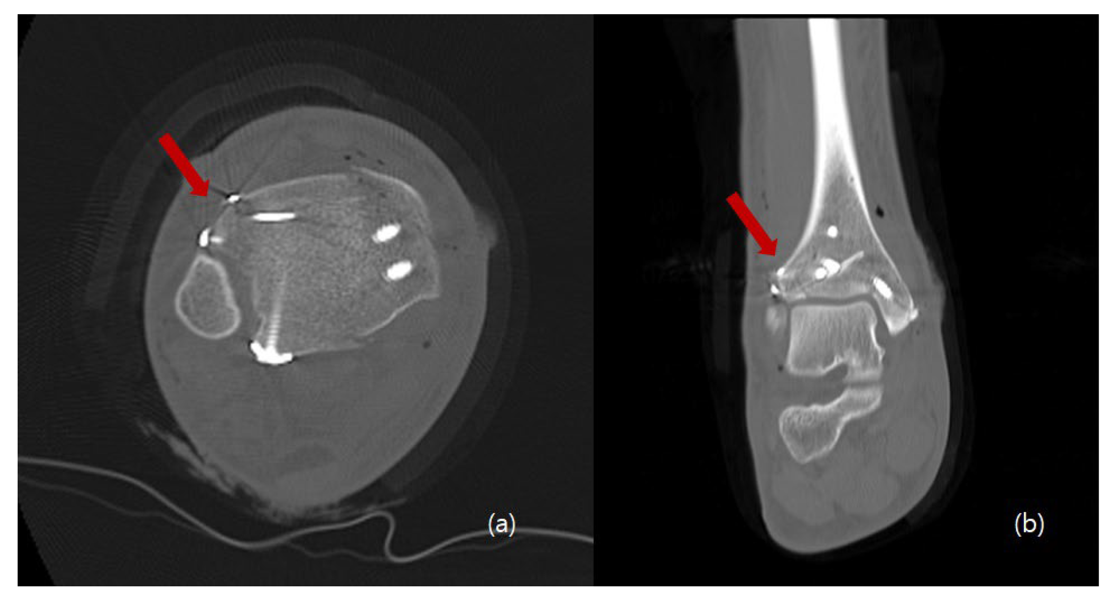 Medicina 58 01005 g005