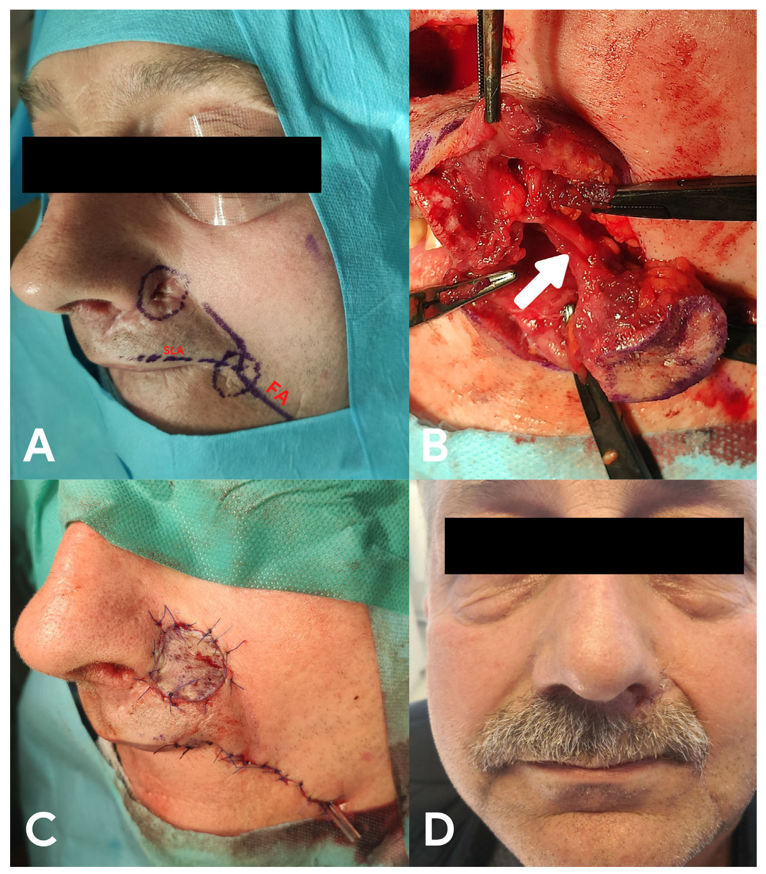 Medicina 58 01012 g004
