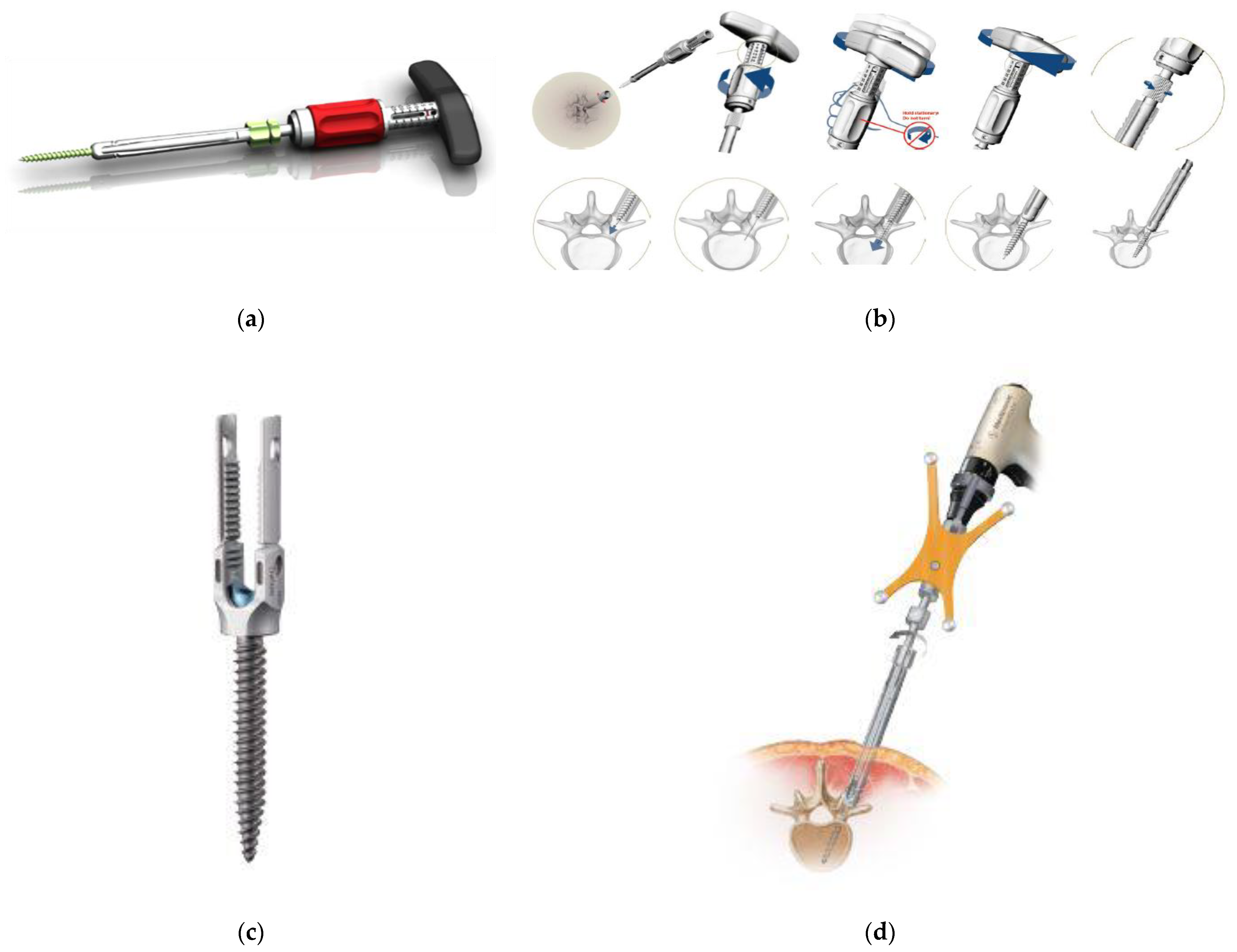 Medicina 58 01064 g005