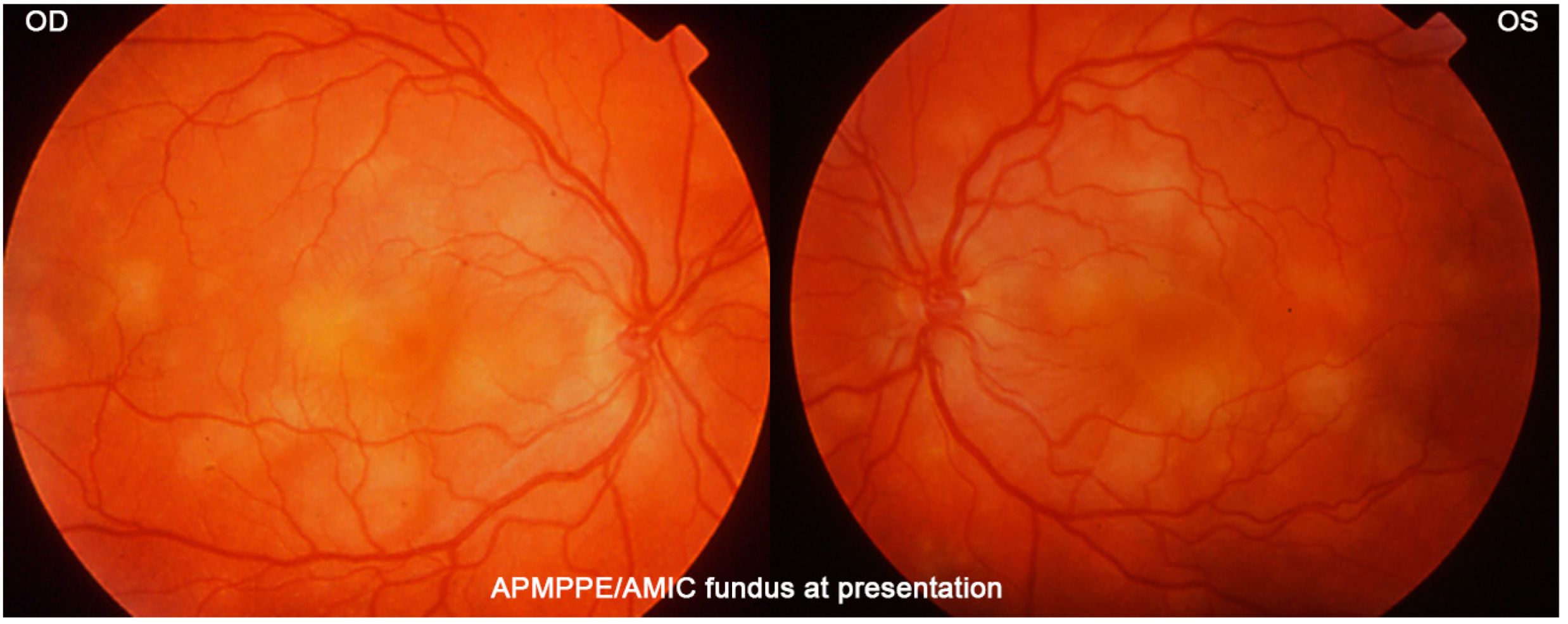 Medicina 58 01070 g017