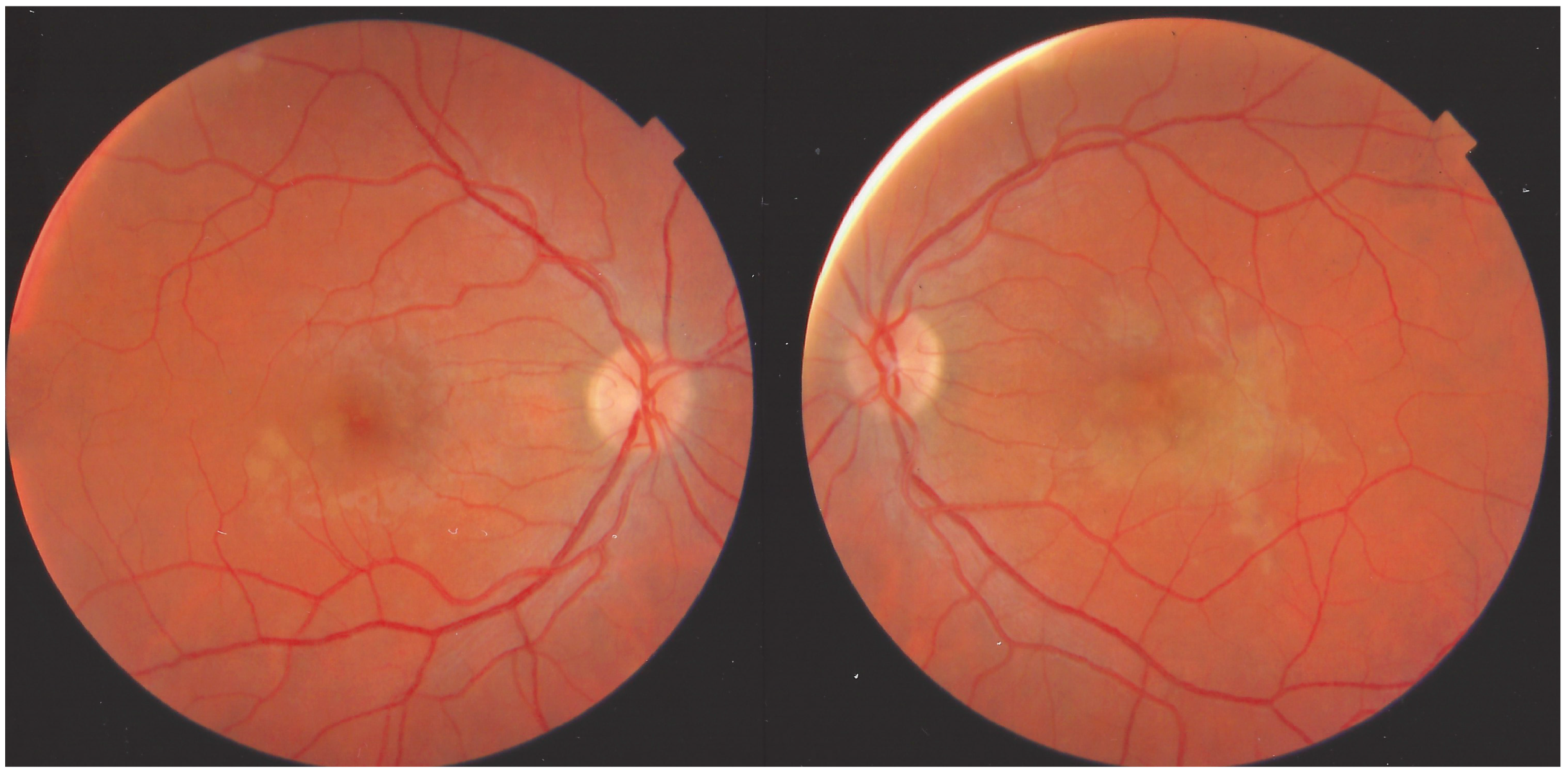 Medicina 58 01070 g023