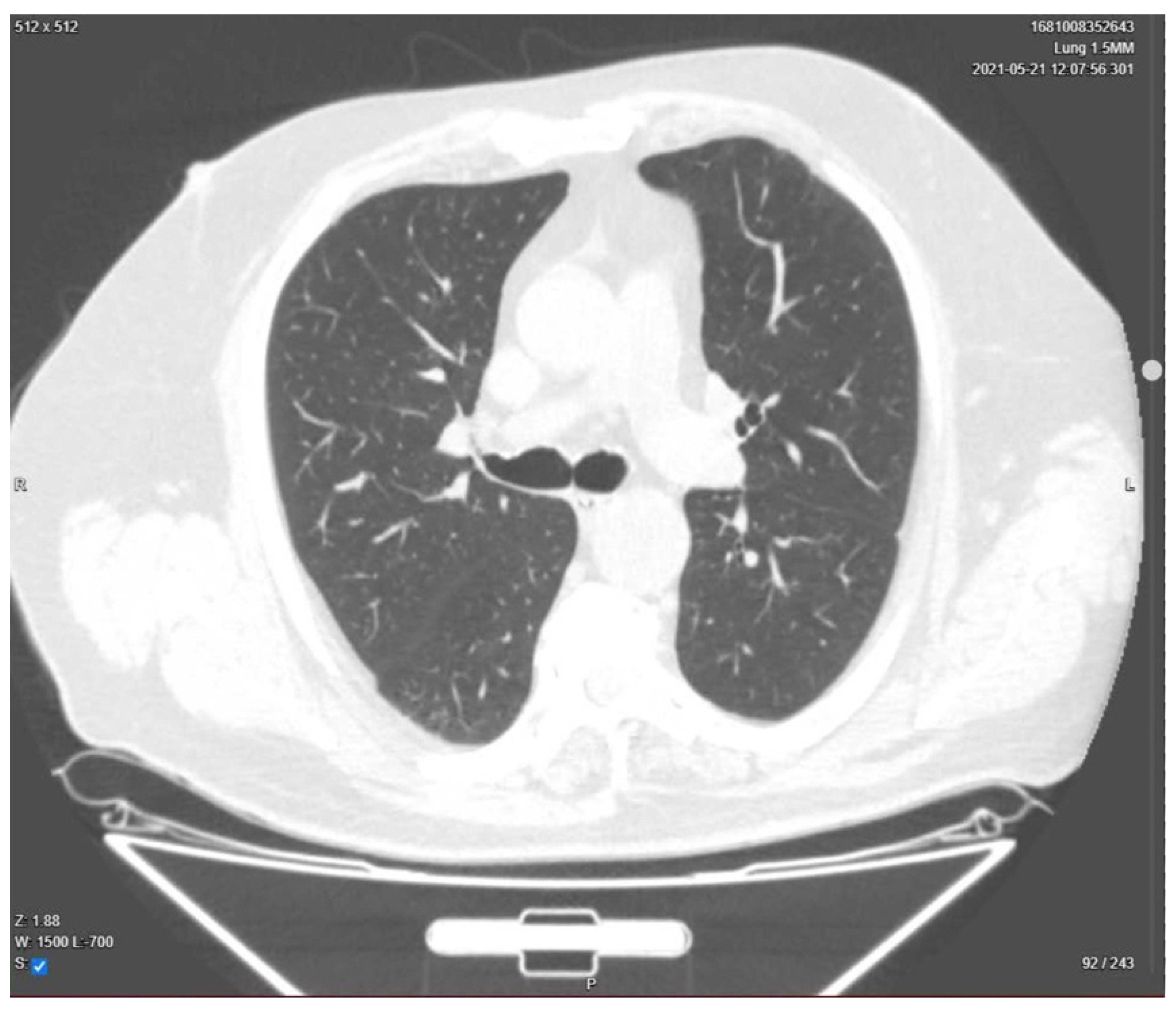 Medicina 58 01088 g004