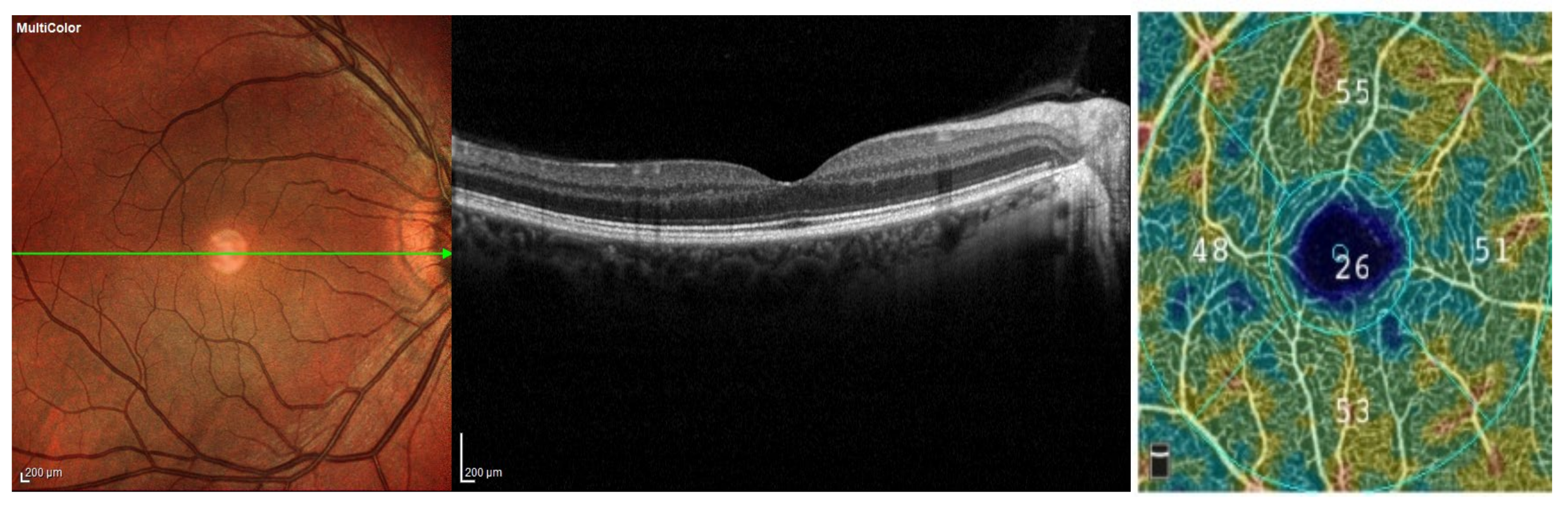 Medicina 58 01092 g002