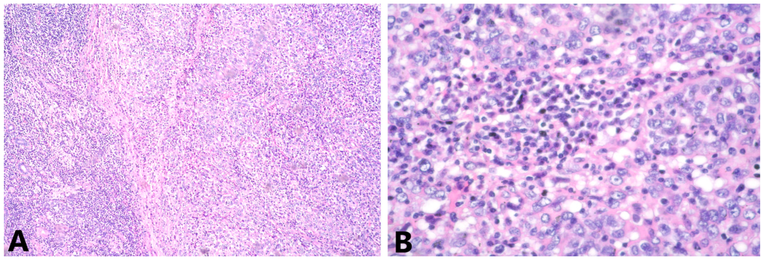 Medicina 58 01146 g003