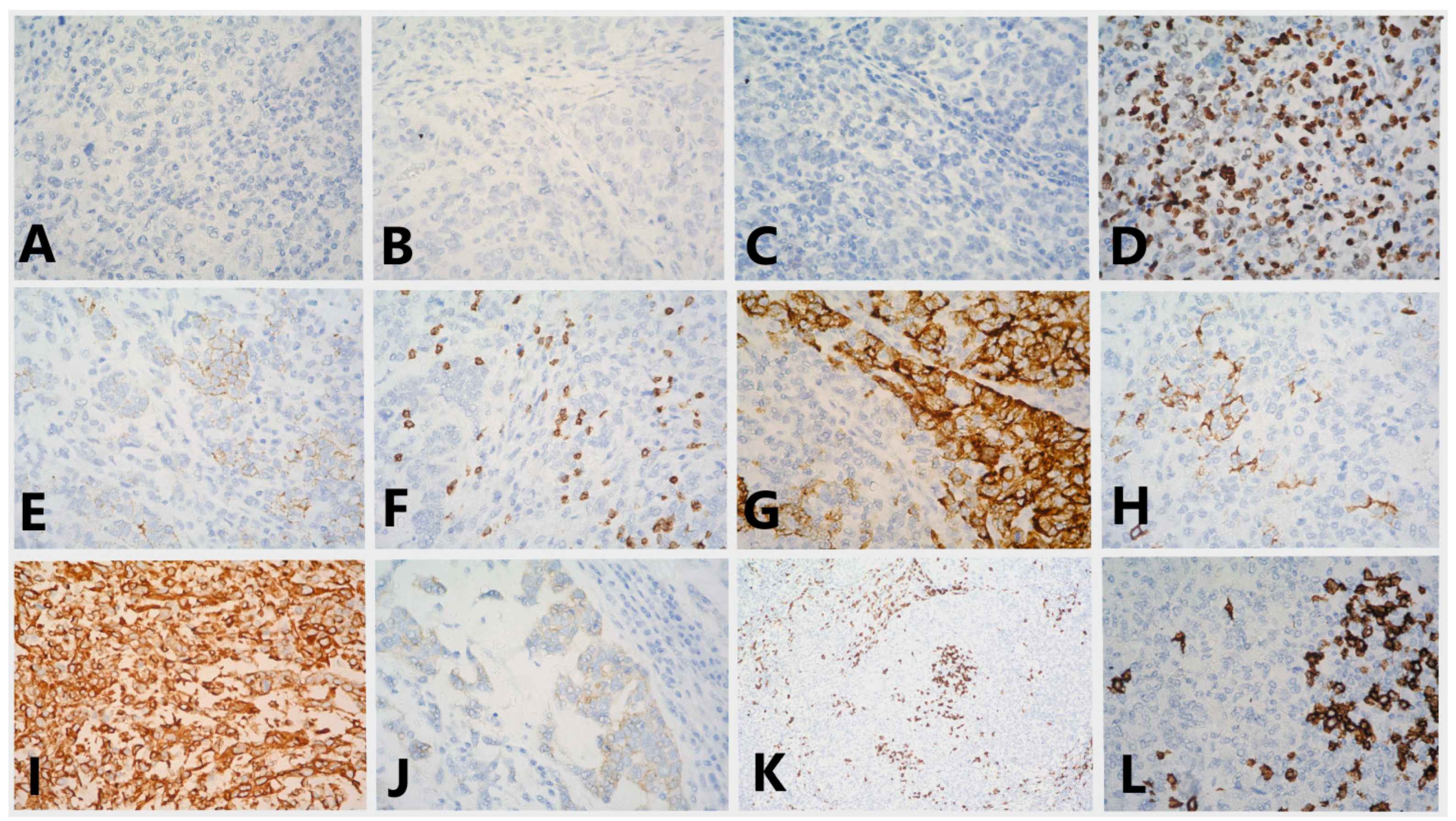 Medicina 58 01146 g004