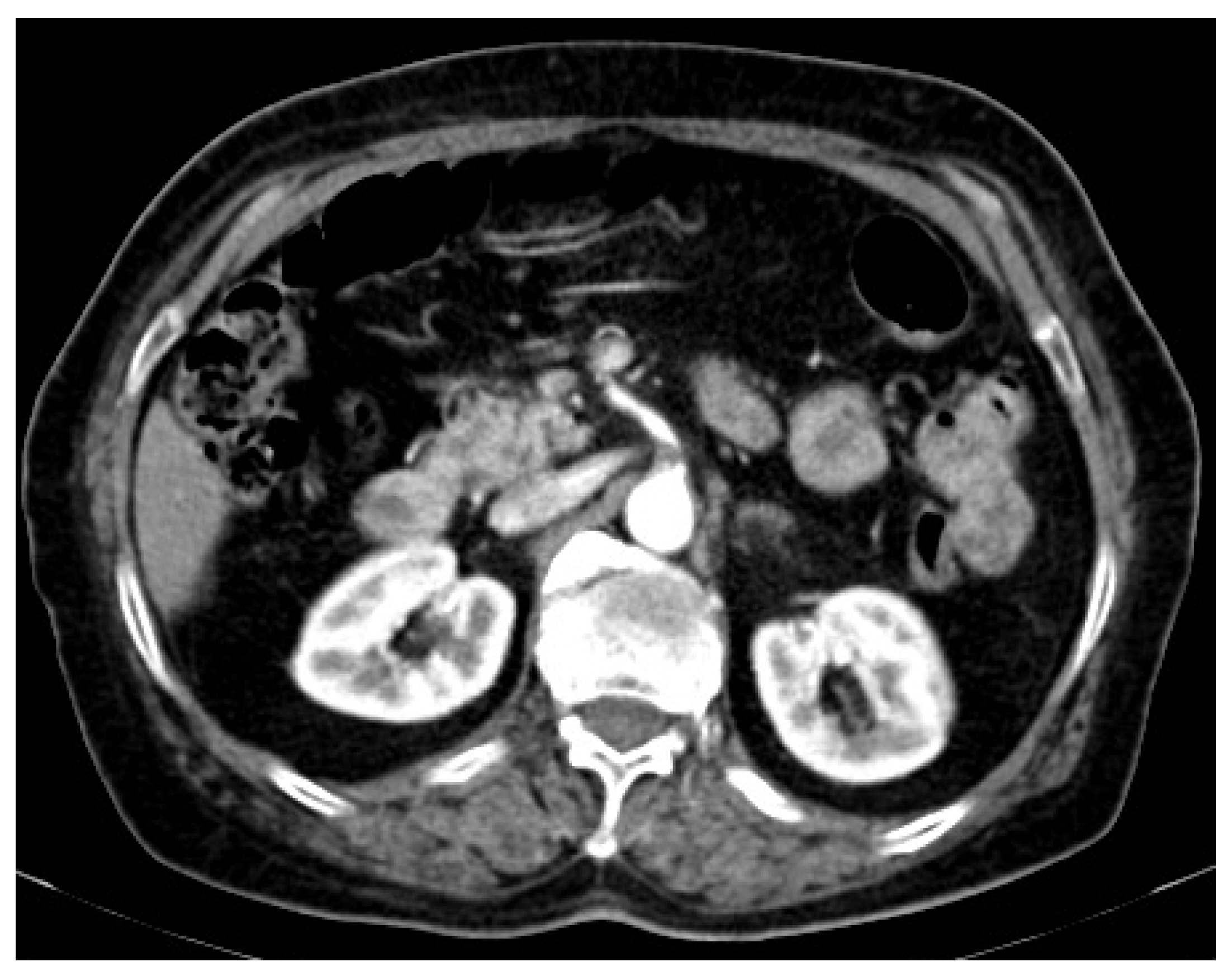 Medicina 58 01147 g002