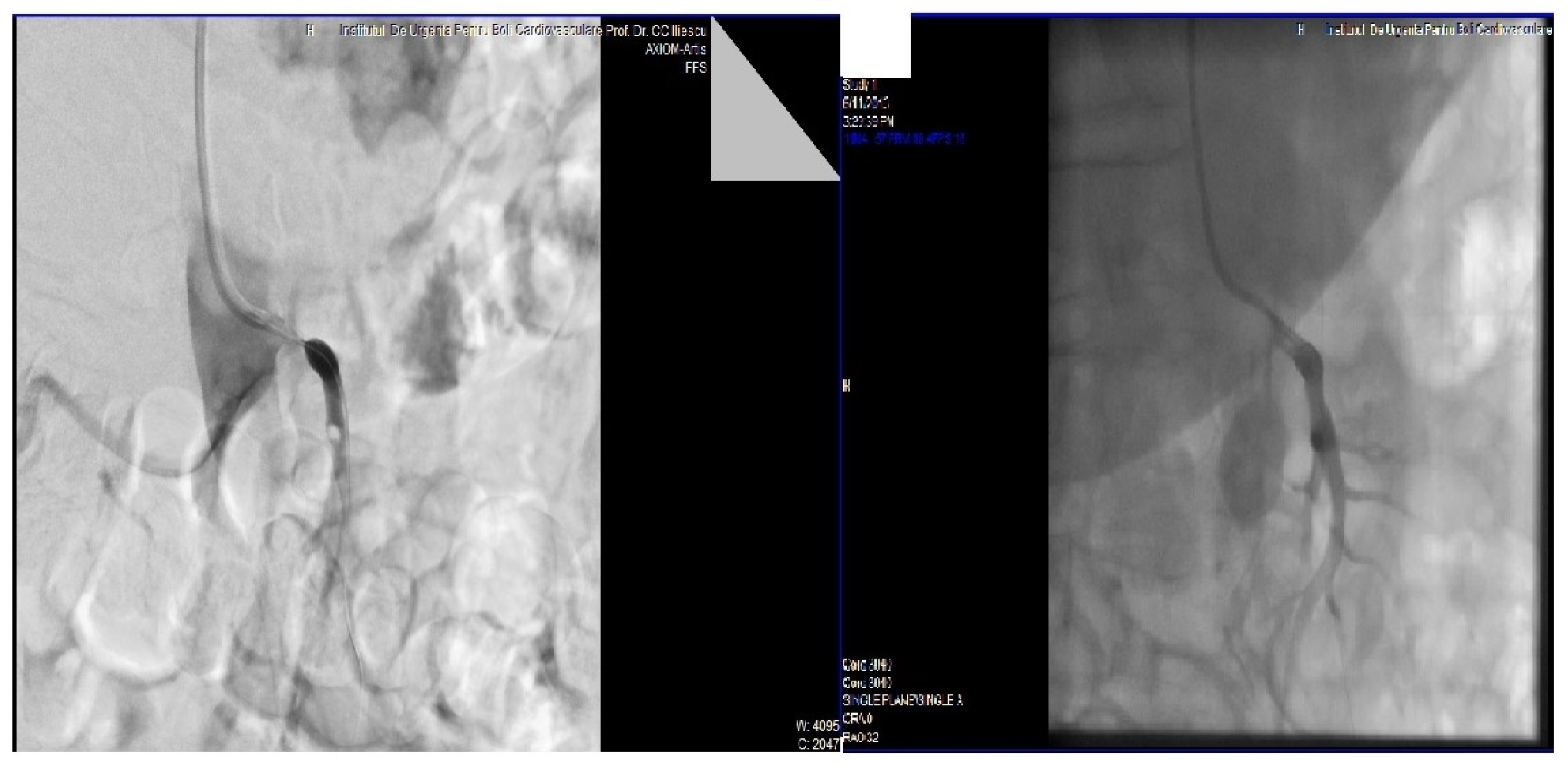 Medicina 58 01147 g003