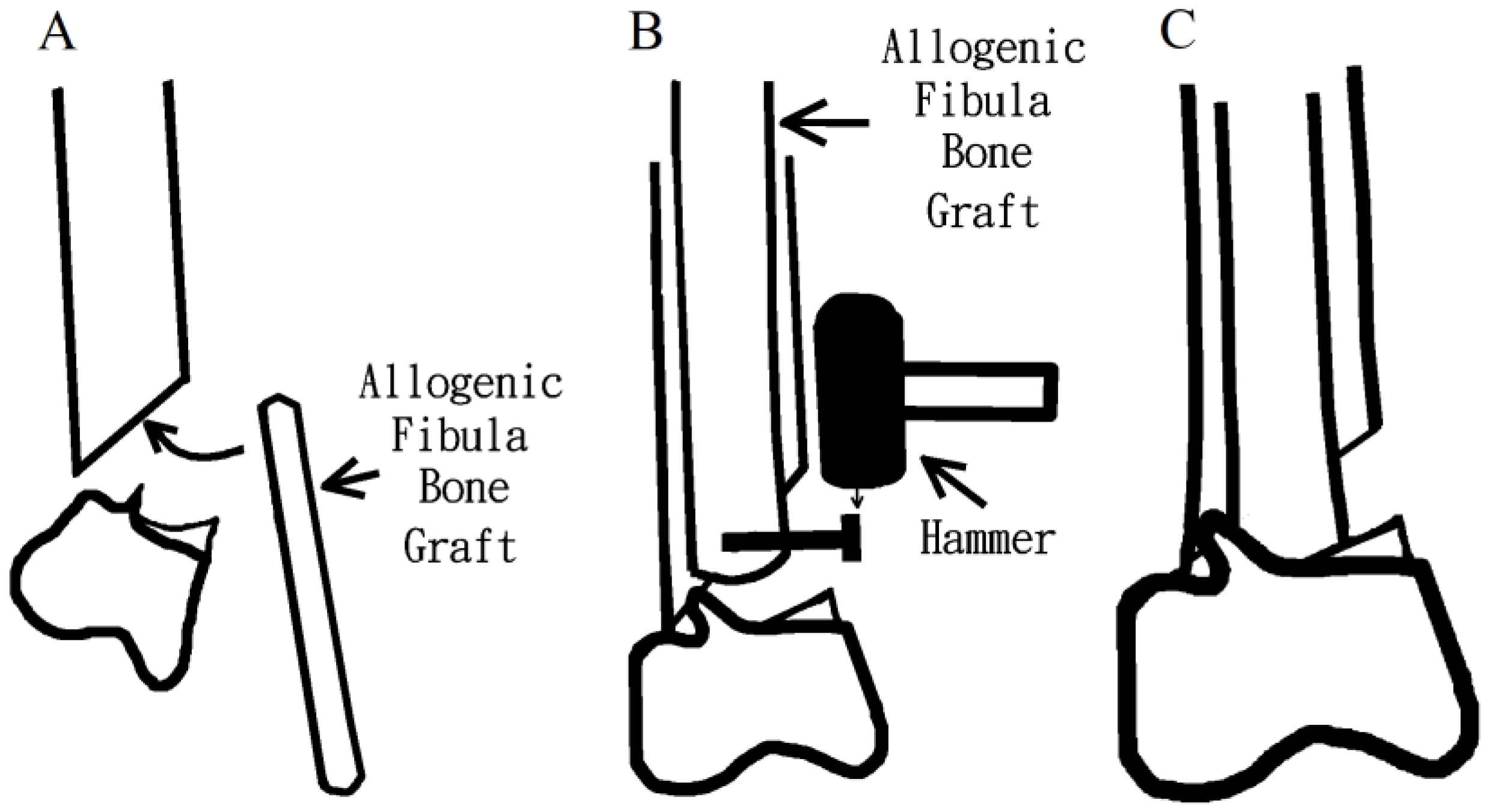 Medicina 58 01148 g002