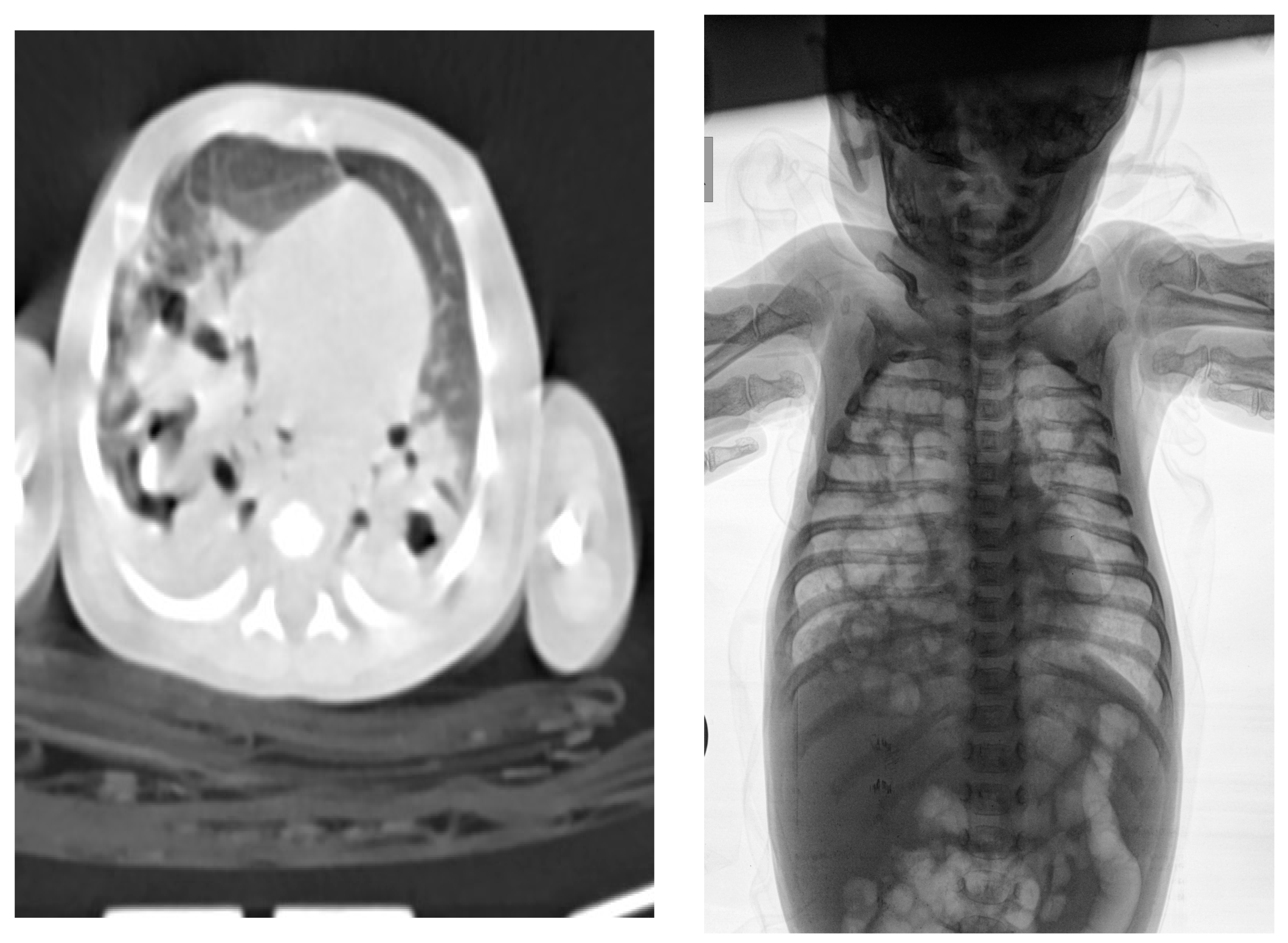 Medicina 58 01150 g003