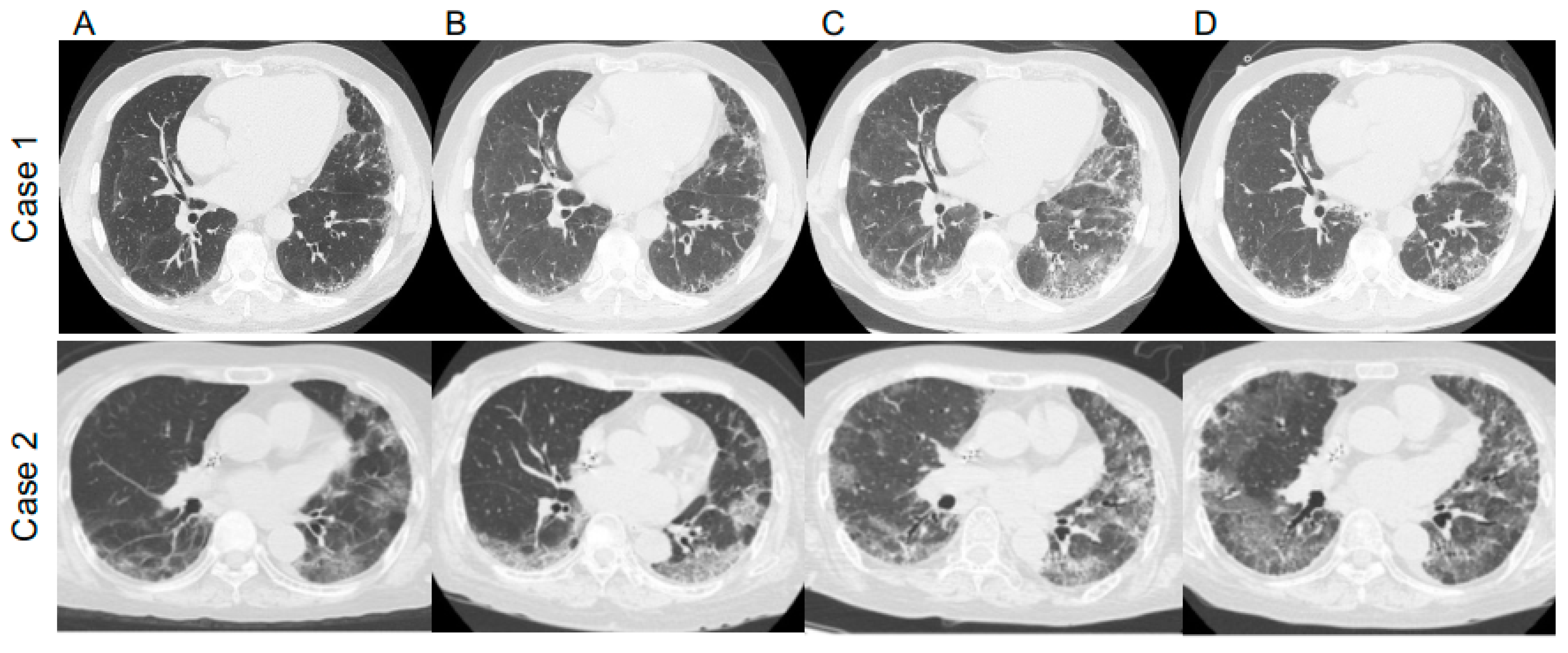Medicina 58 01151 g002