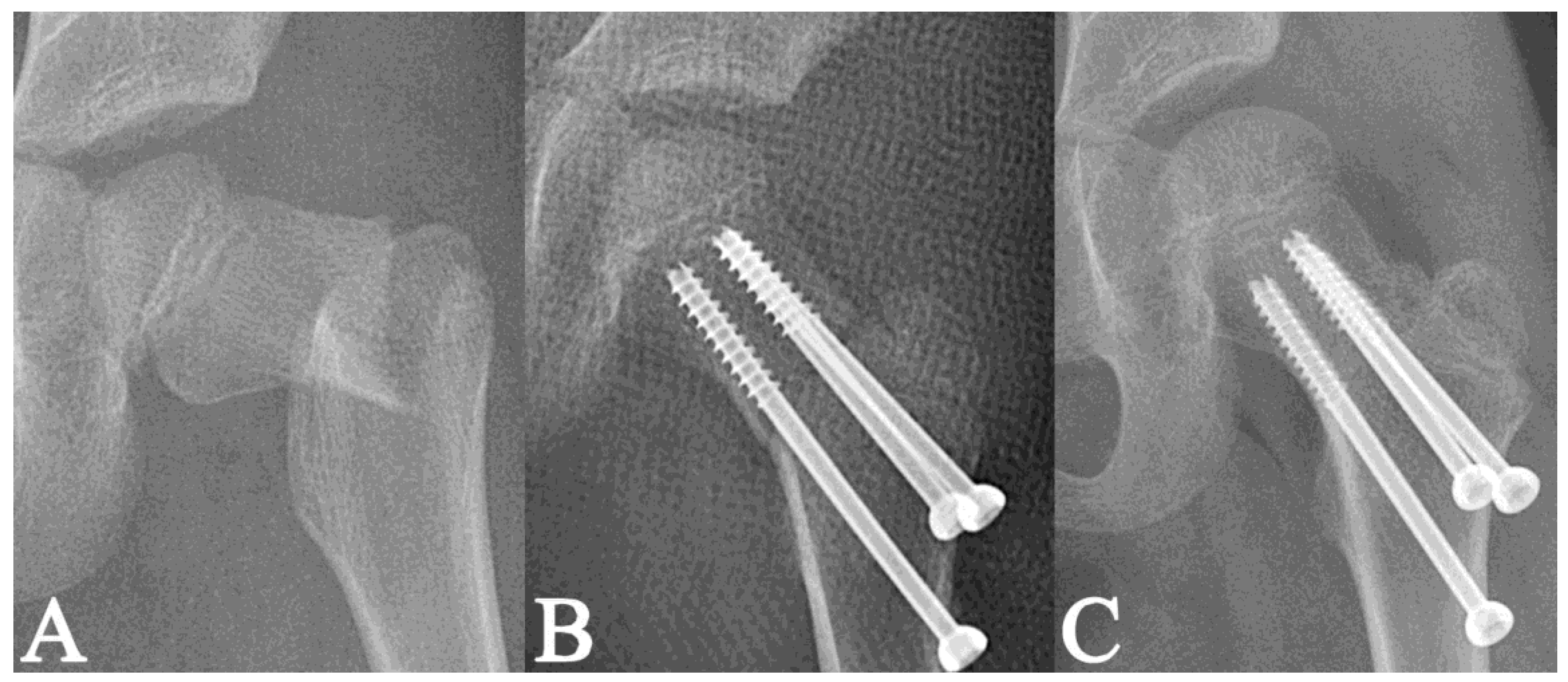 Medicina 58 01153 g006