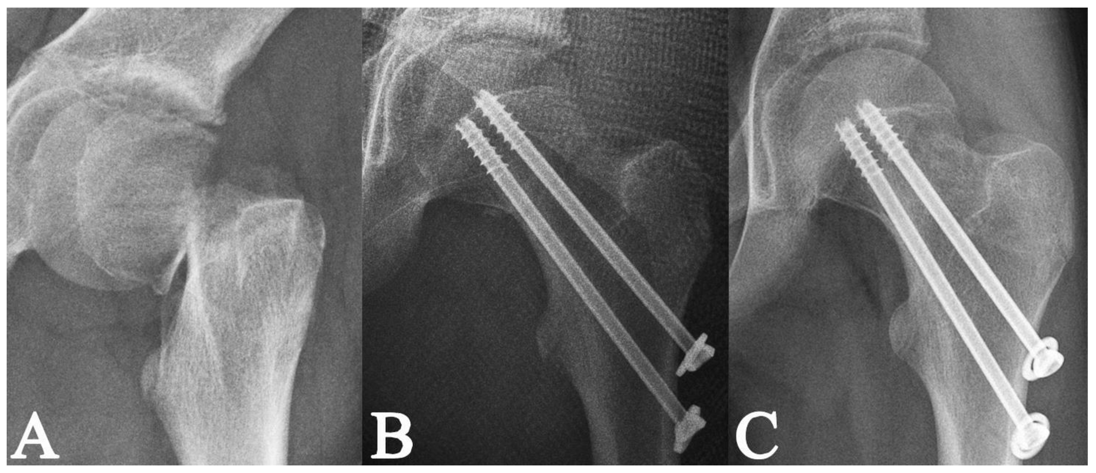 Medicina 58 01153 g008