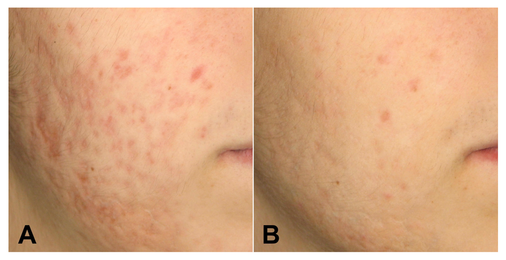 Medicina 58 01190 g002