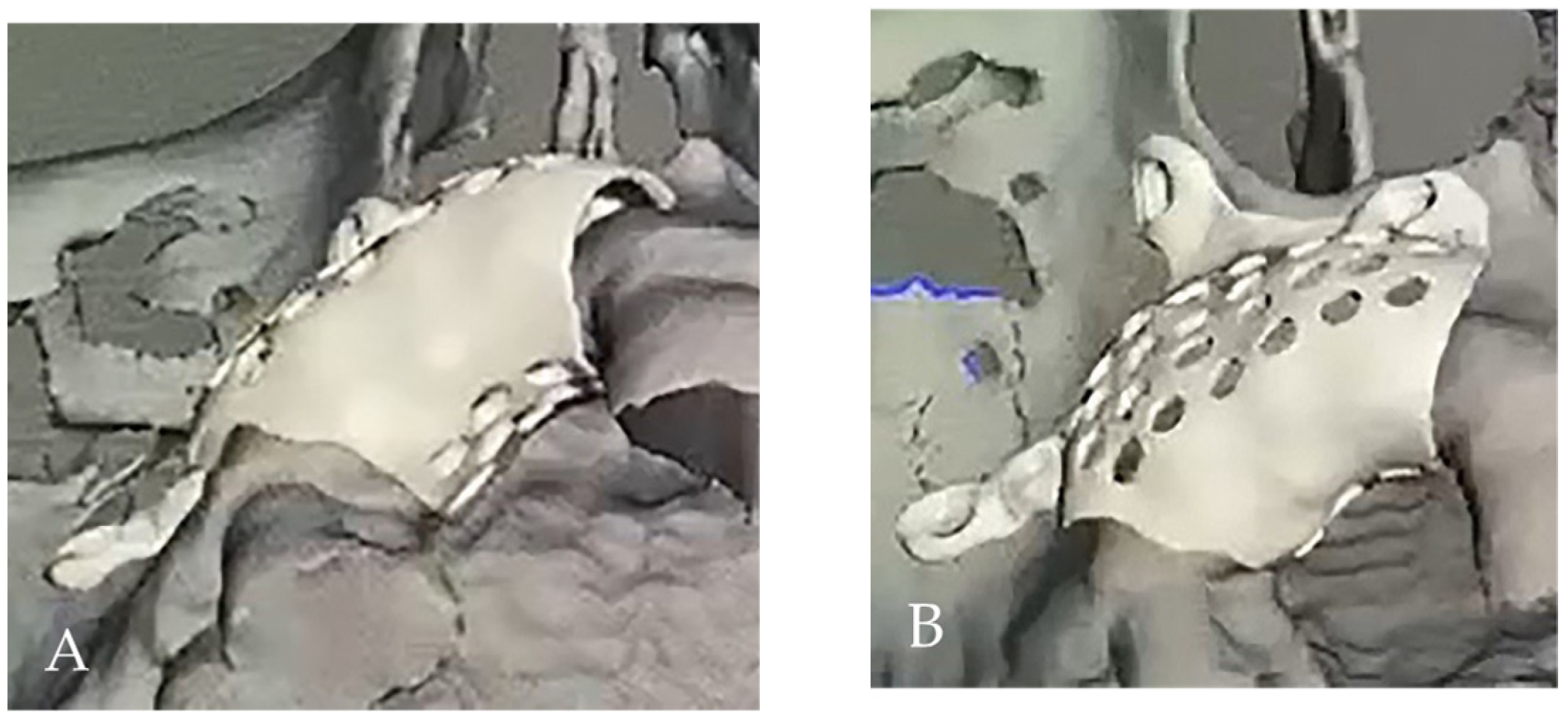 Medicina 58 01192 g004