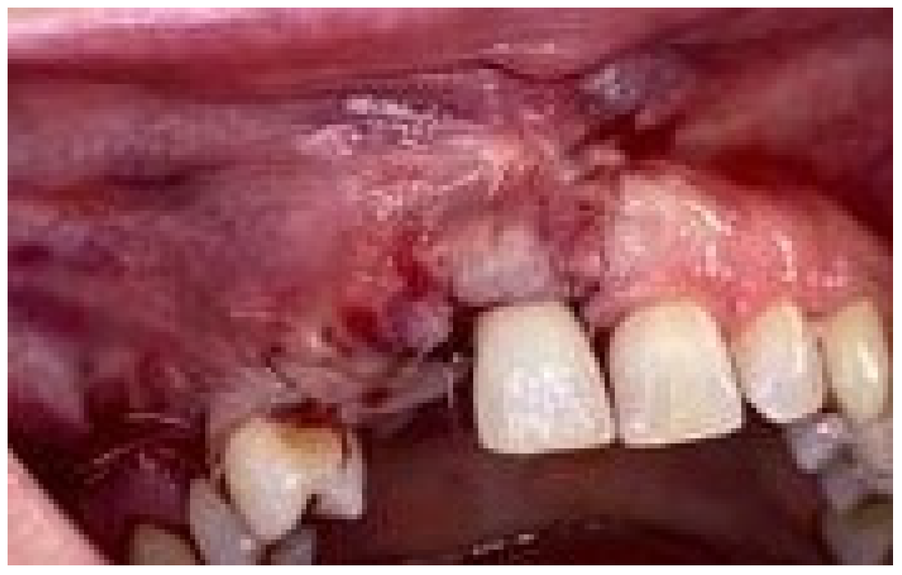 Medicina 58 01192 g008