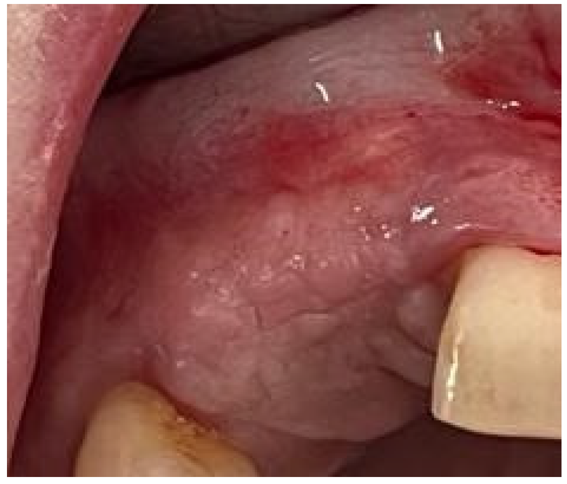 Medicina 58 01192 g009