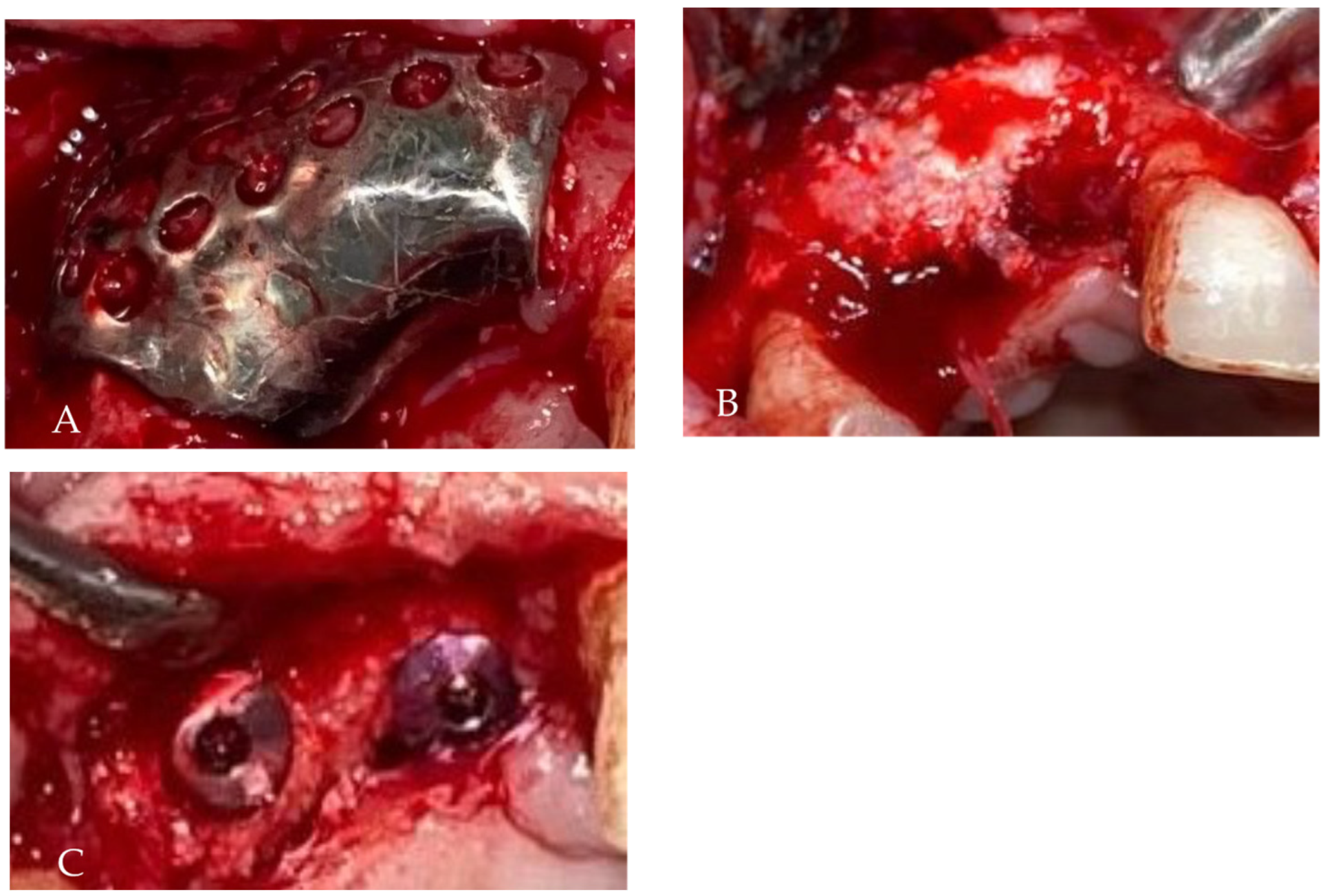 Medicina 58 01192 g010