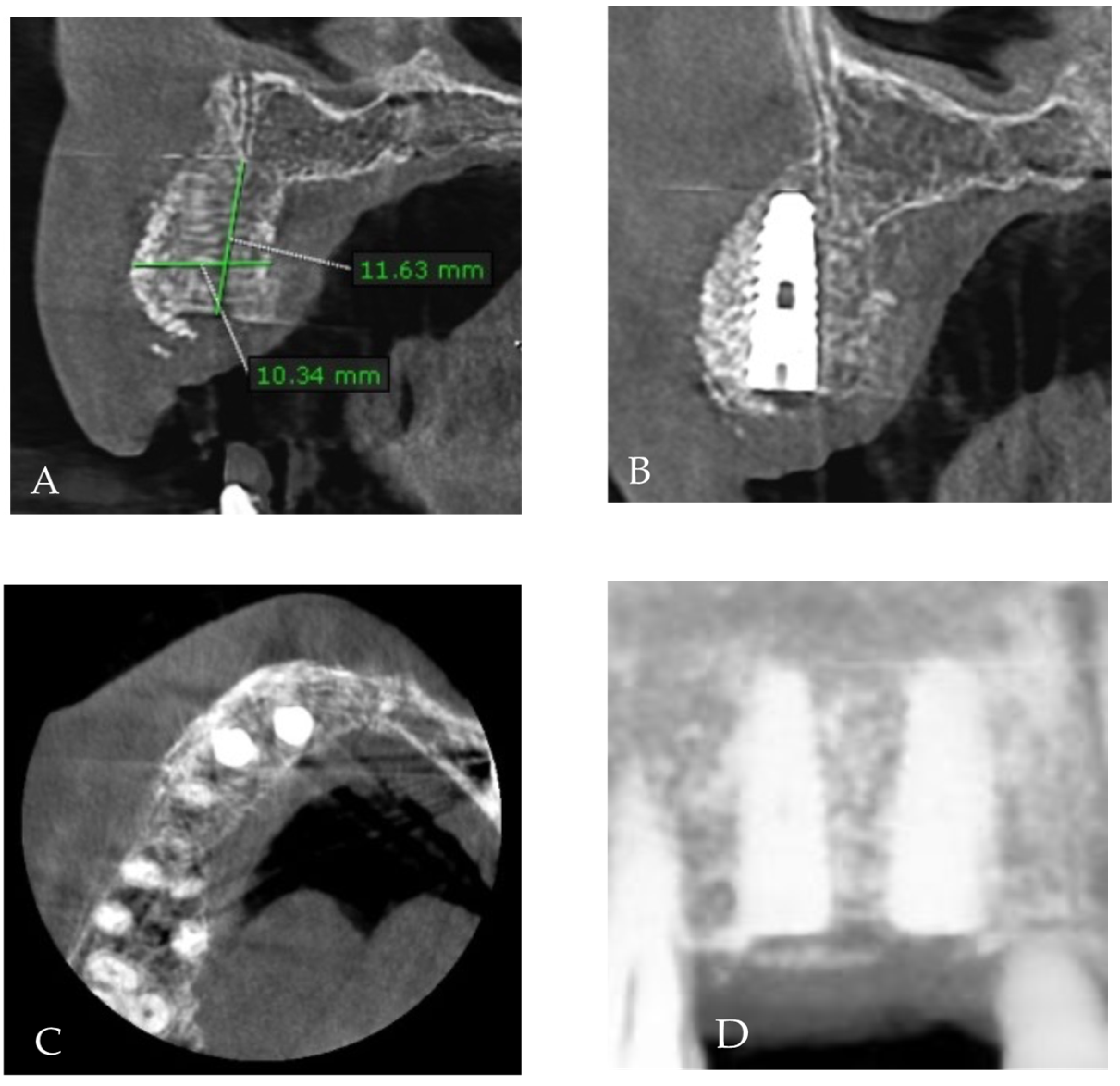 Medicina 58 01192 g011