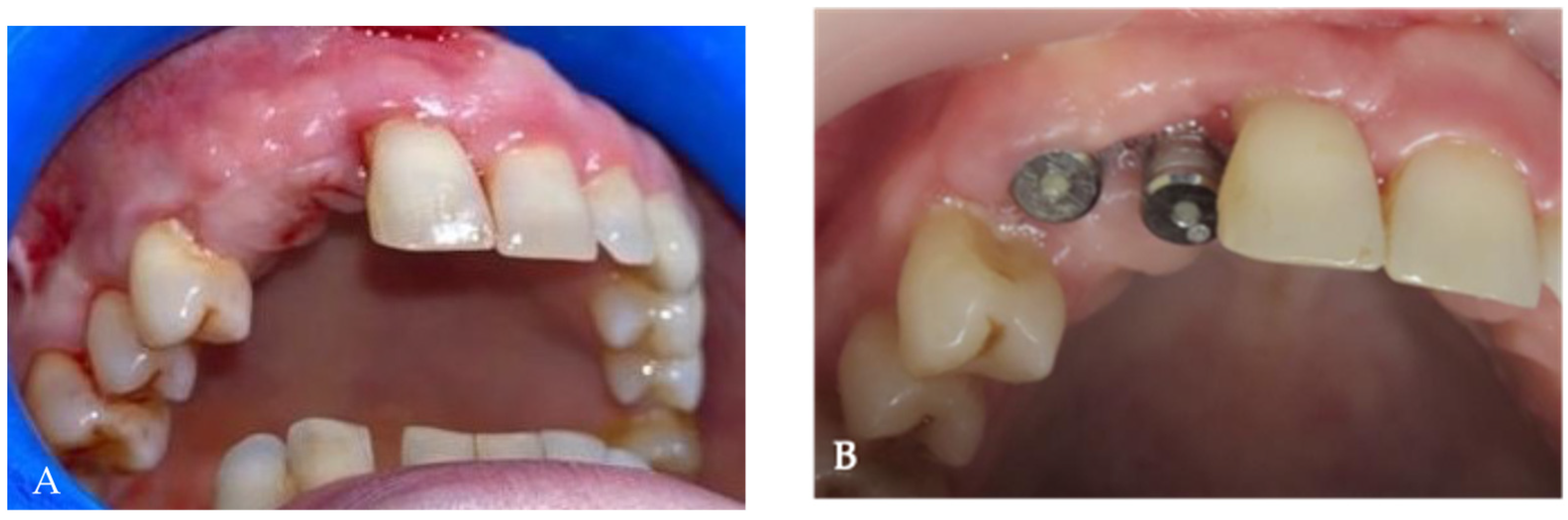 Medicina 58 01192 g012
