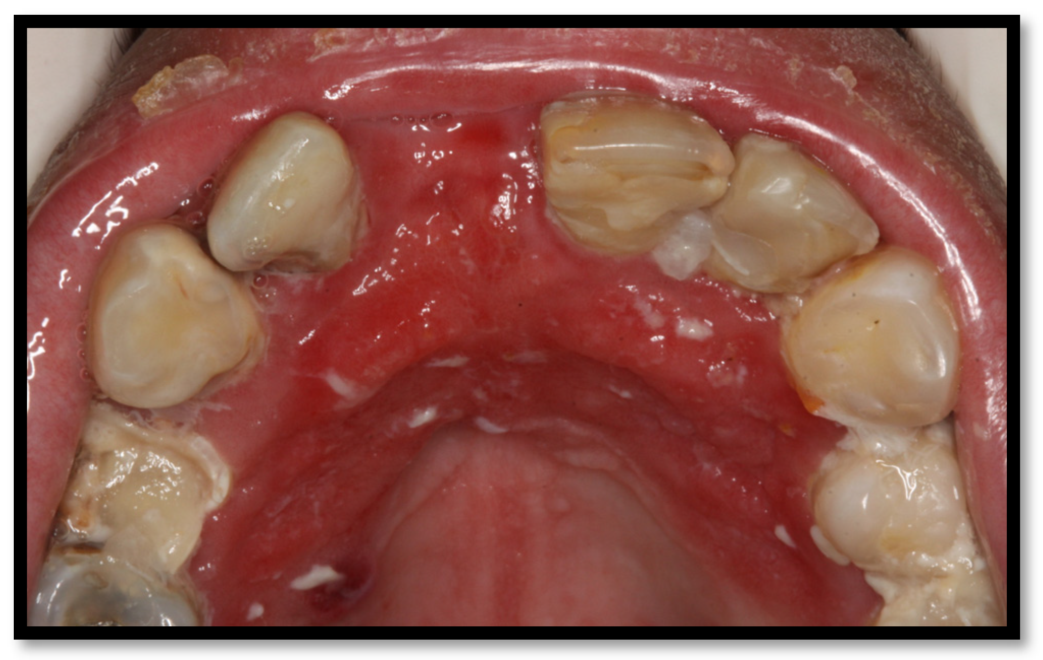 Medicina 58 01214 g002 Medicina 58 01214 g002