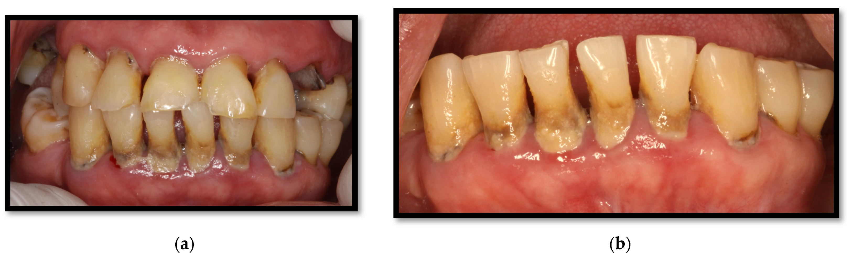 Medicina 58 01214 g005 Medicina 58 01214 g005