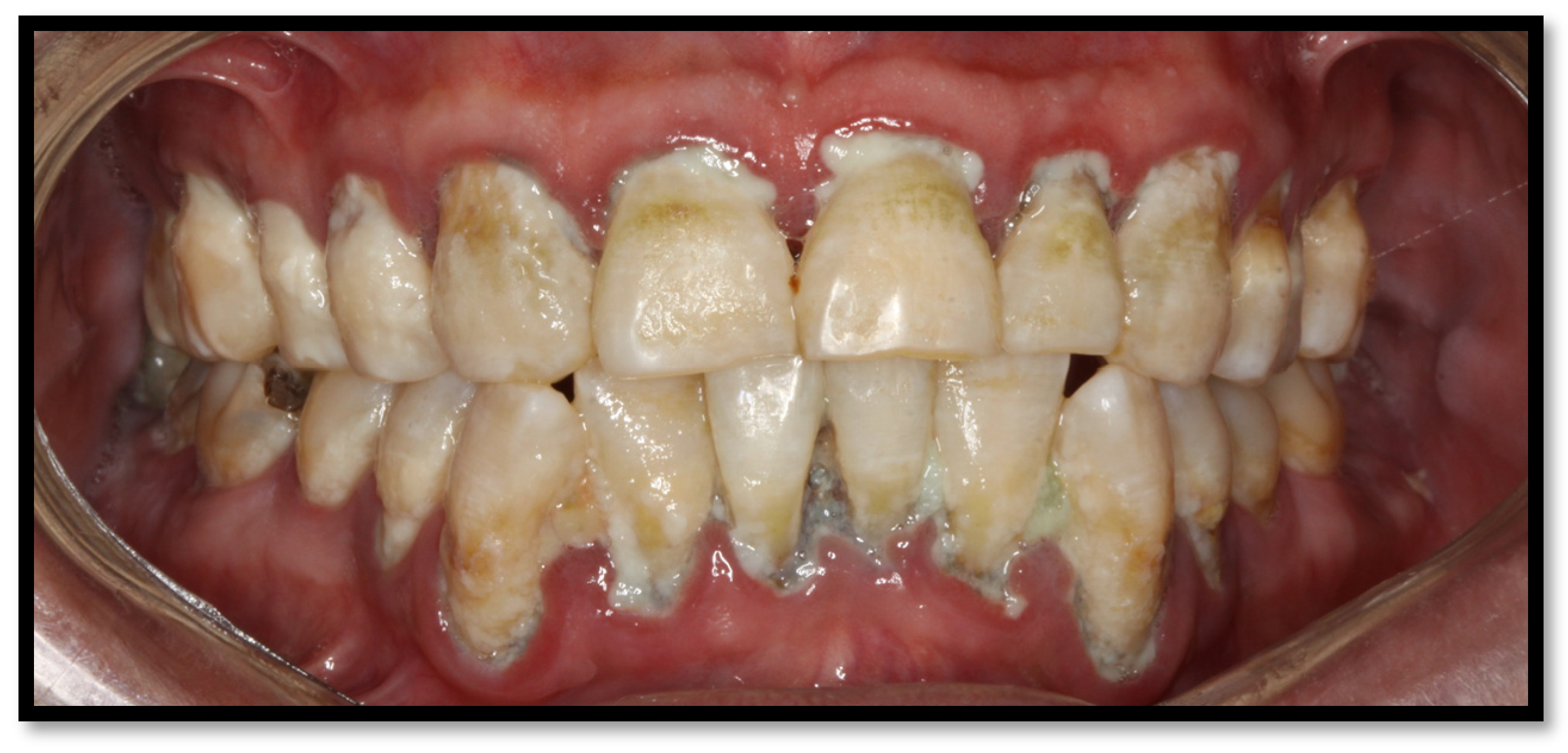 Medicina 58 01214 g006 Medicina 58 01214 g006