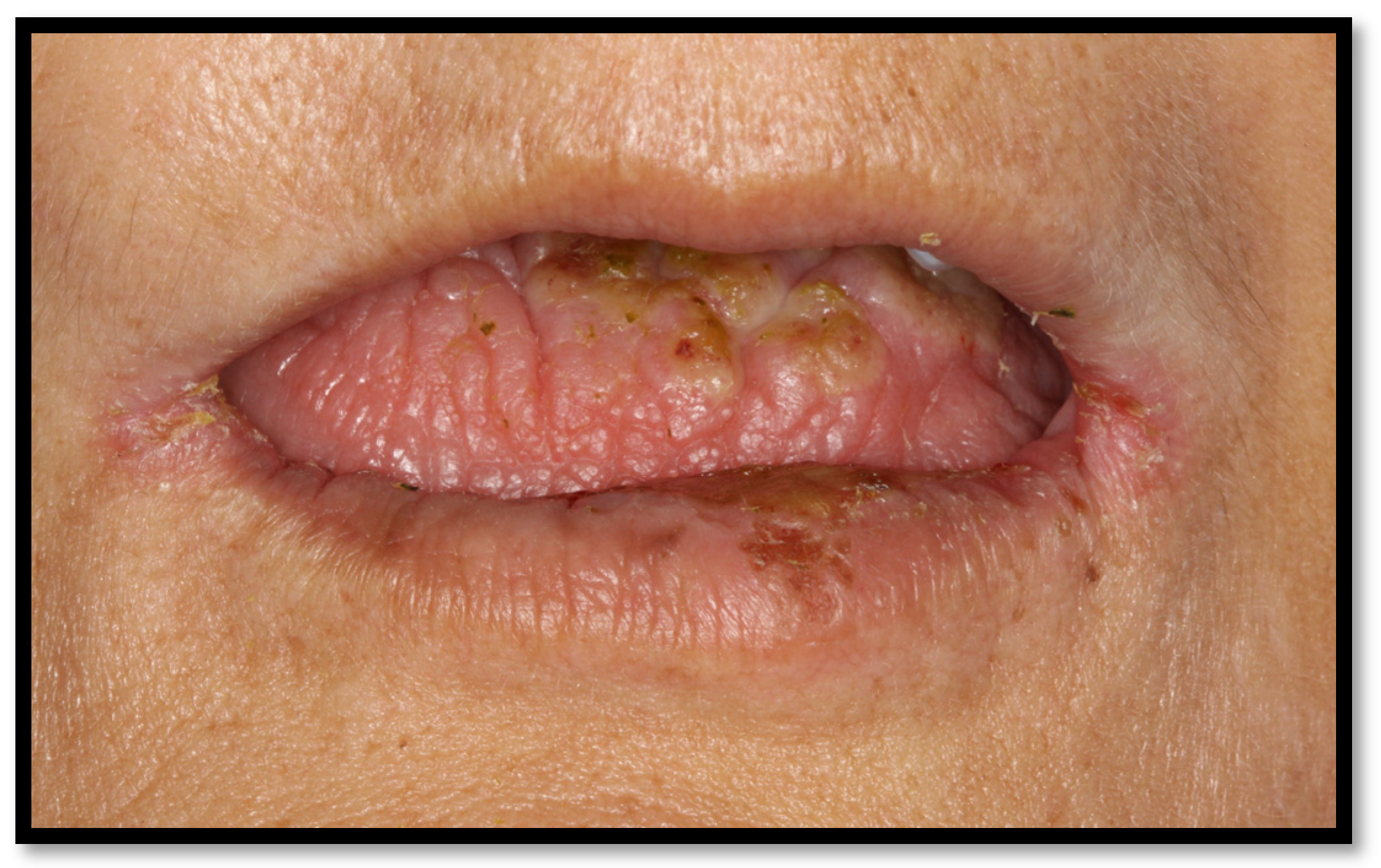 Medicina 58 01214 g007 Medicina 58 01214 g007