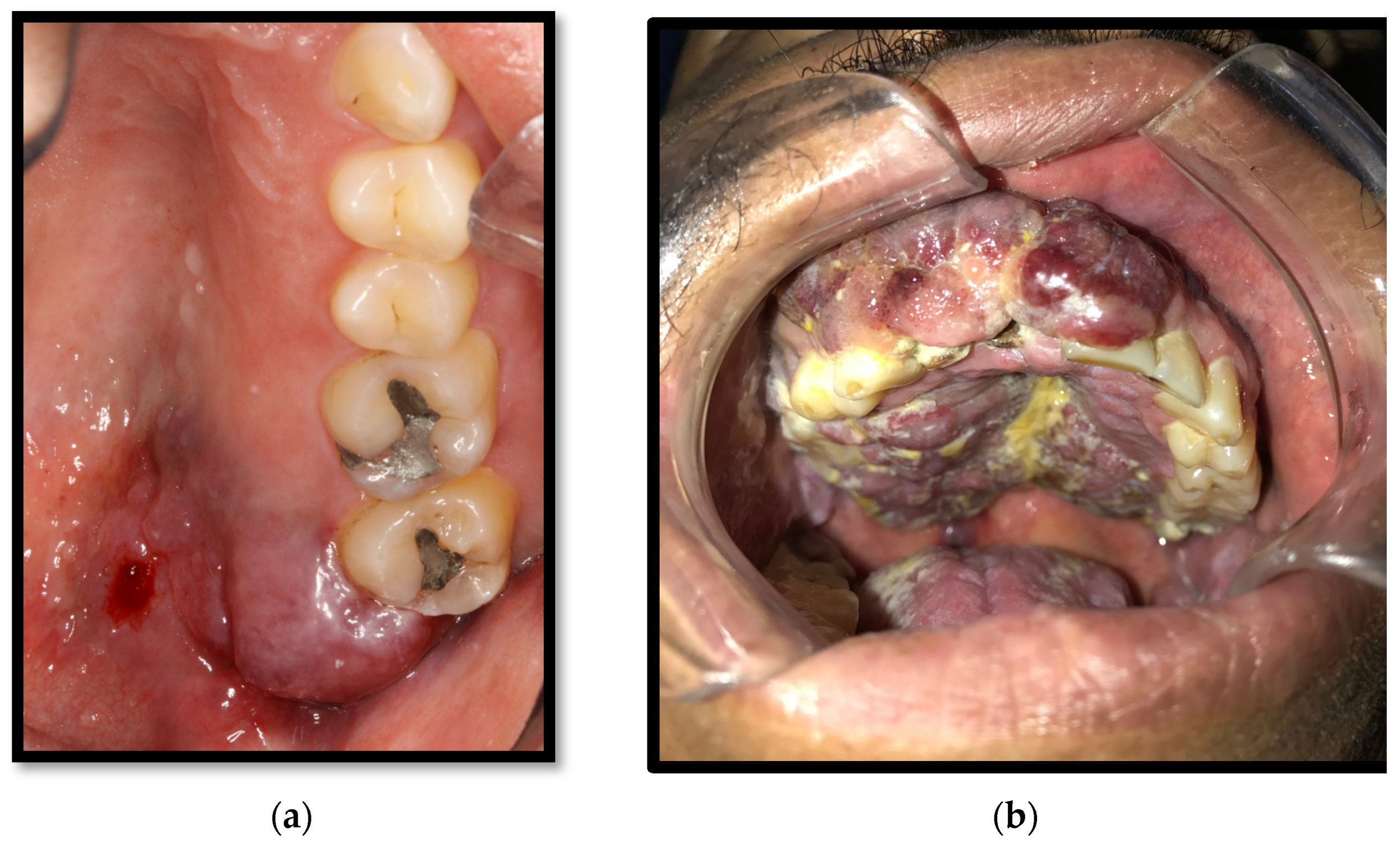 Medicina 58 01214 g008 Medicina 58 01214 g008