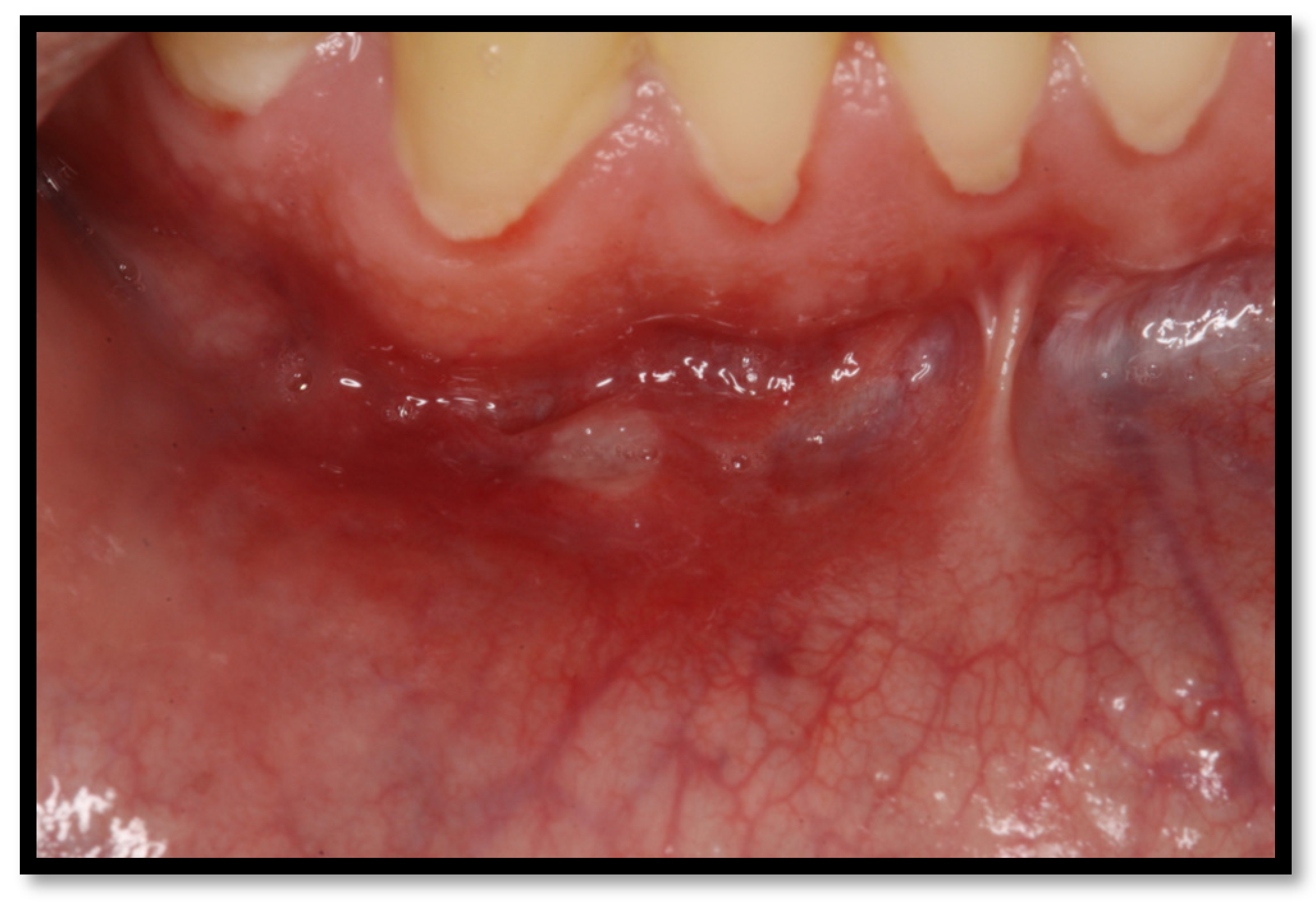 Medicina 58 01214 g009 Medicina 58 01214 g009