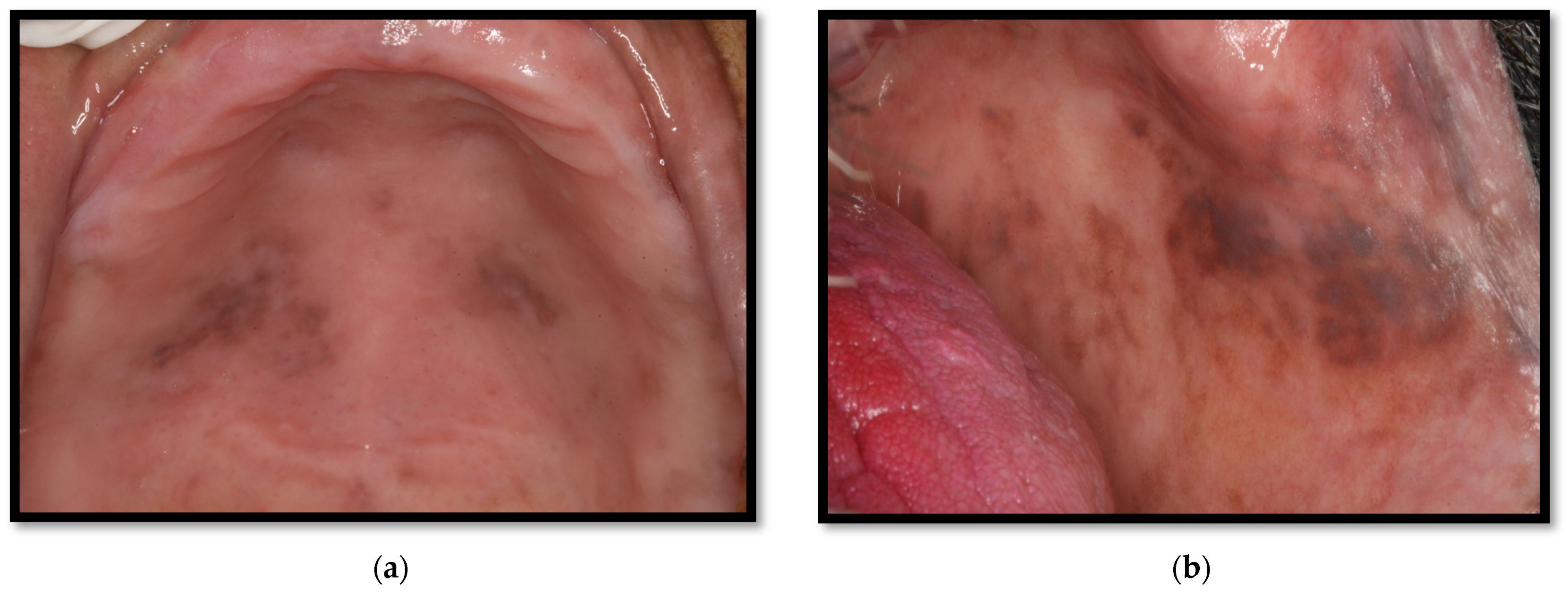 Medicina 58 01214 g012 Medicina 58 01214 g012