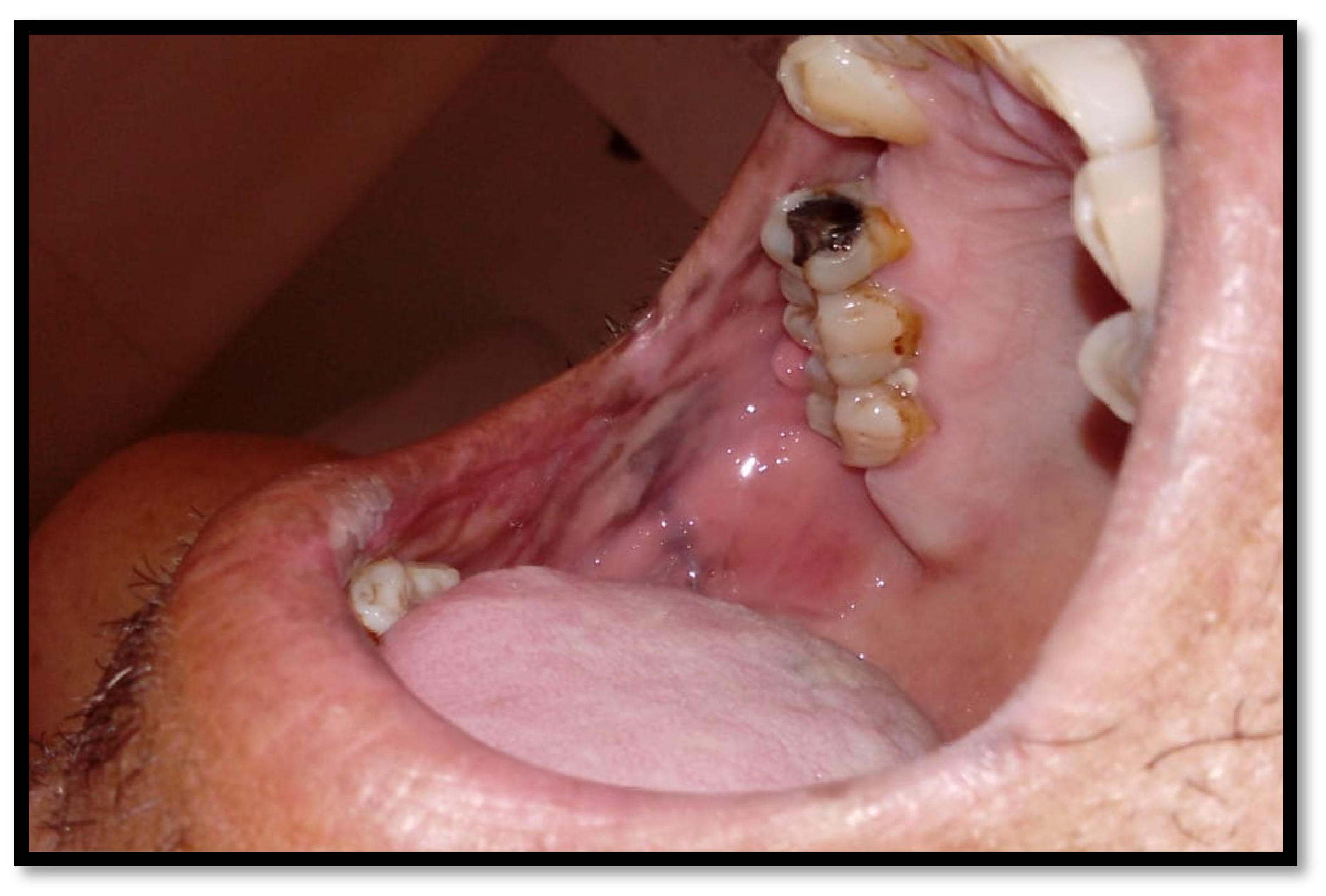 Medicina 58 01214 g013 Medicina 58 01214 g013