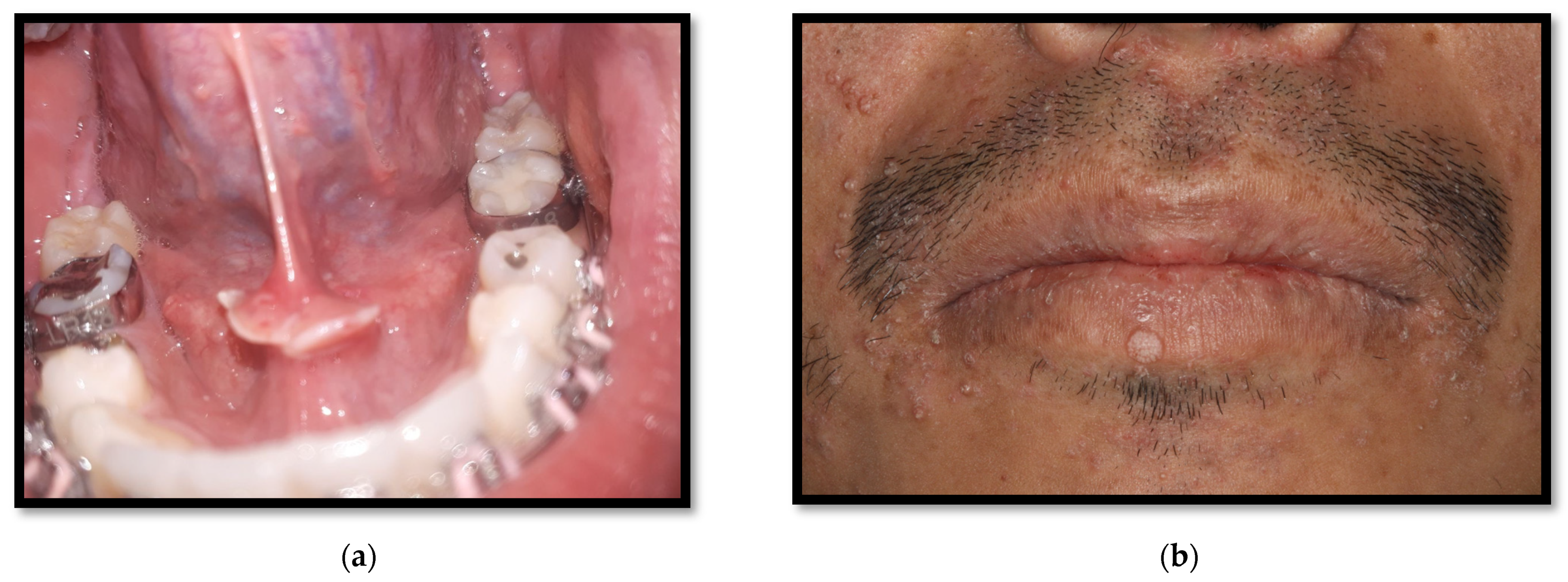 Medicina 58 01214 g014 Medicina 58 01214 g014