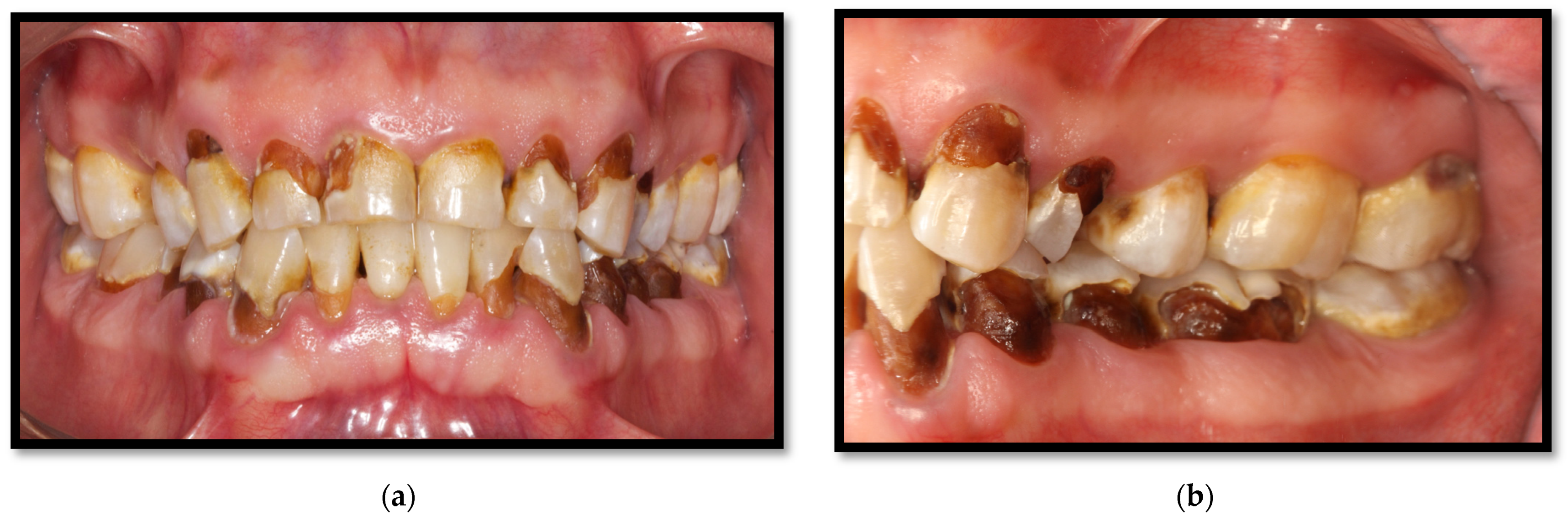 Medicina 58 01214 g015 Medicina 58 01214 g015