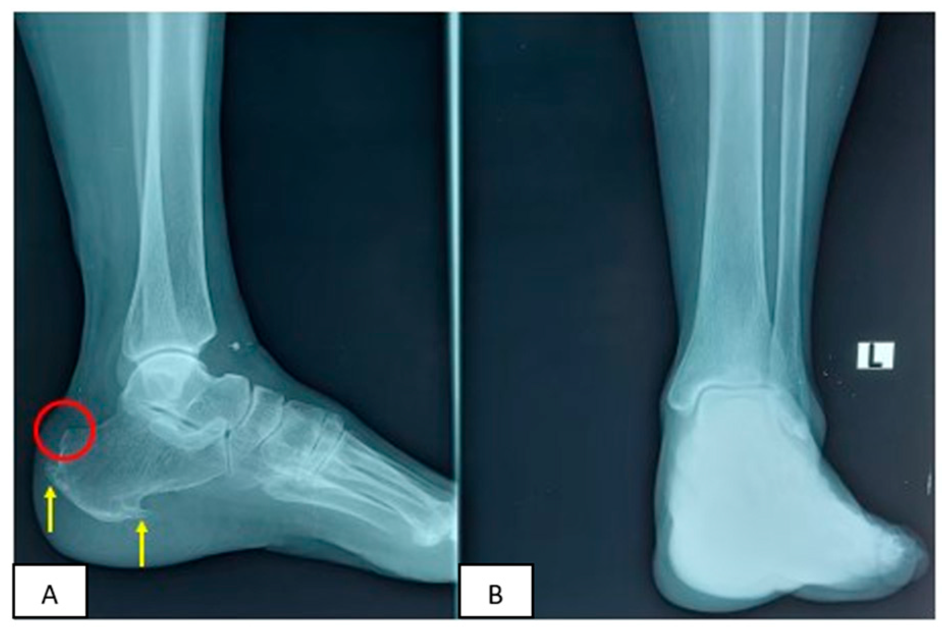 Medicina 58 01216 g002