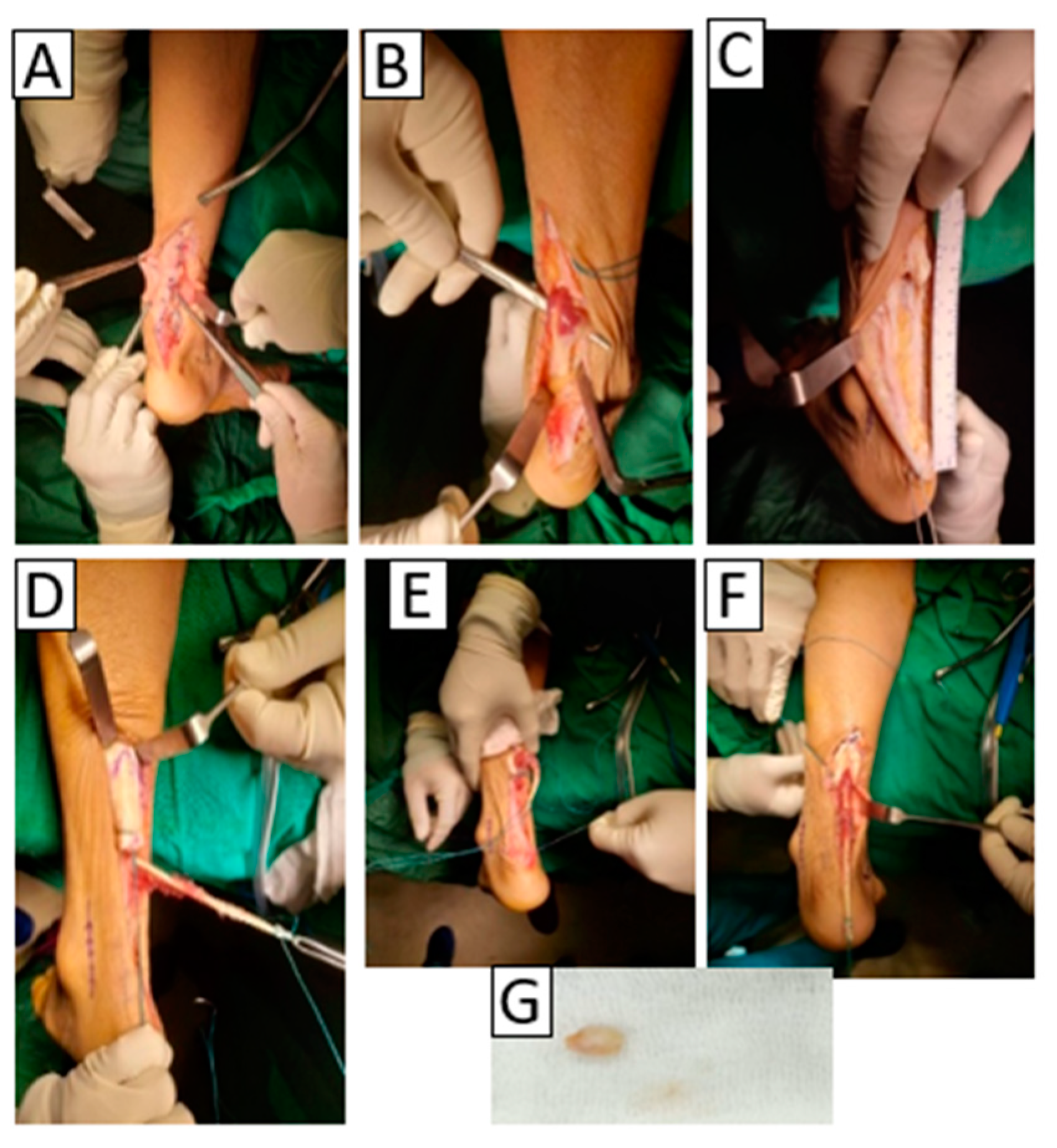 Medicina 58 01216 g003