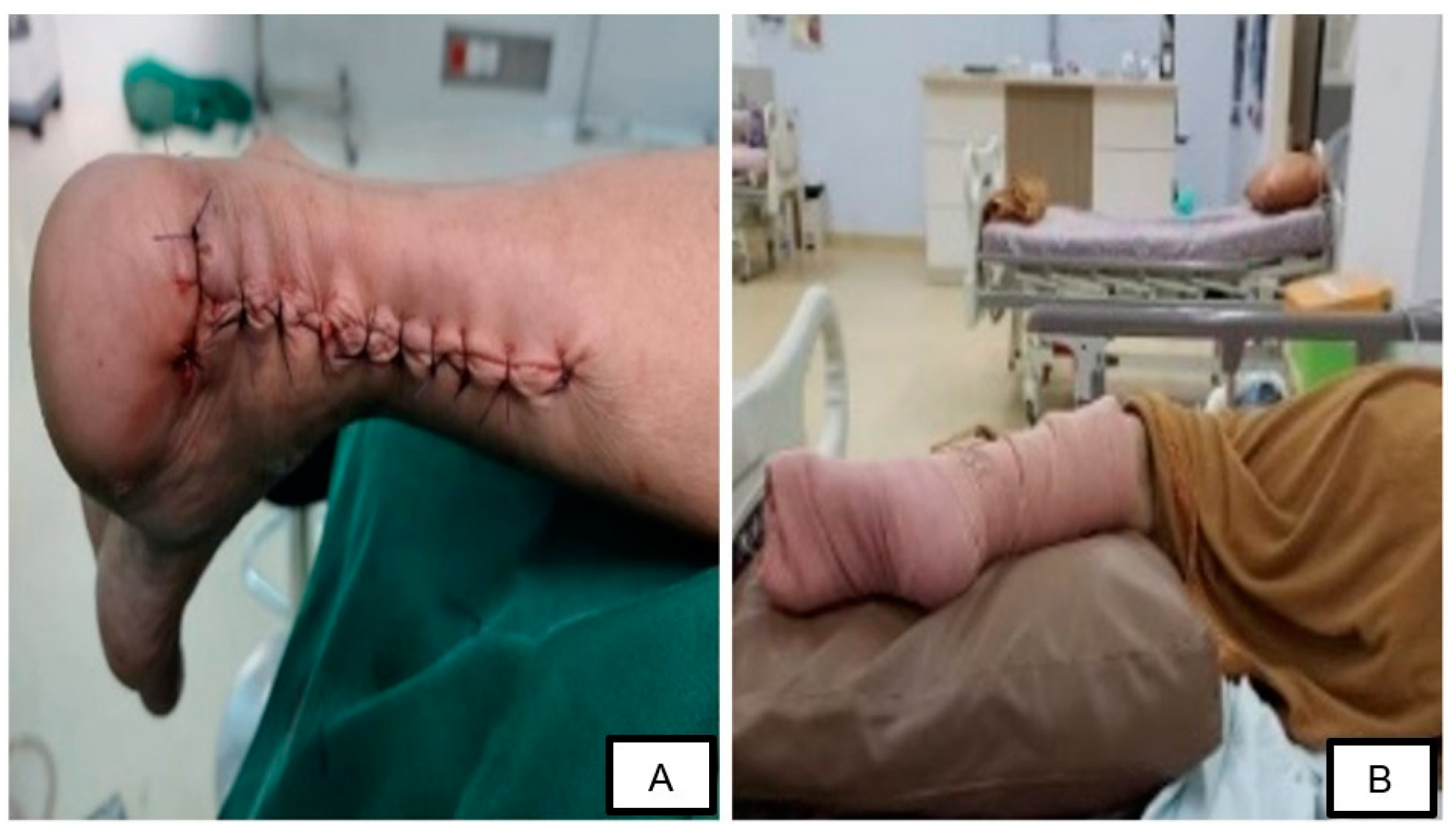 Medicina 58 01216 g004