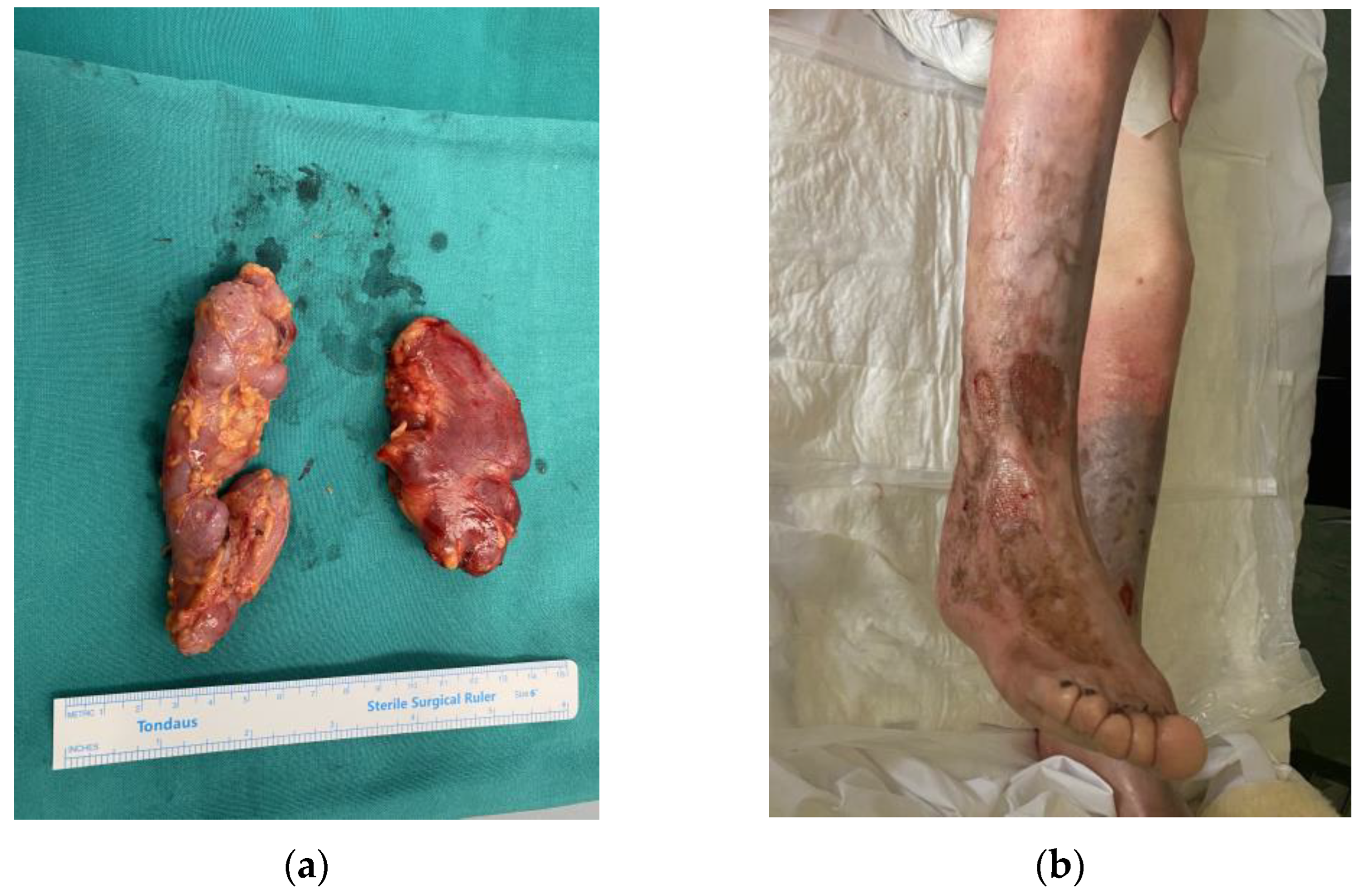 Medicina 58 01222 g002