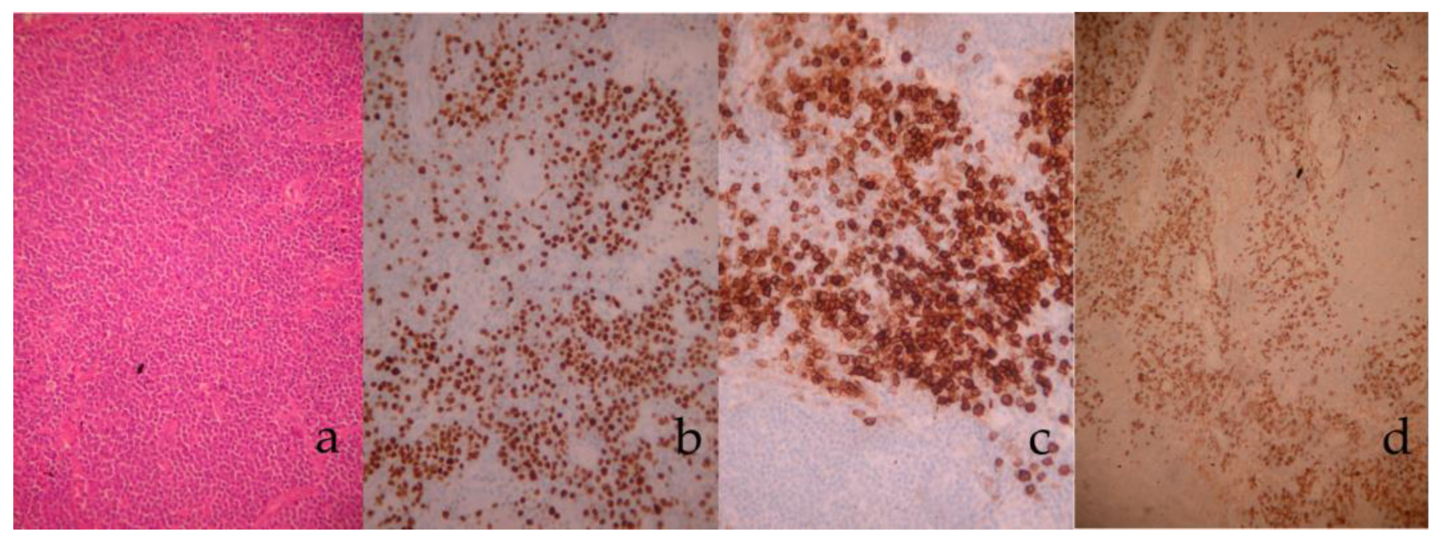 Medicina 58 01222 g003