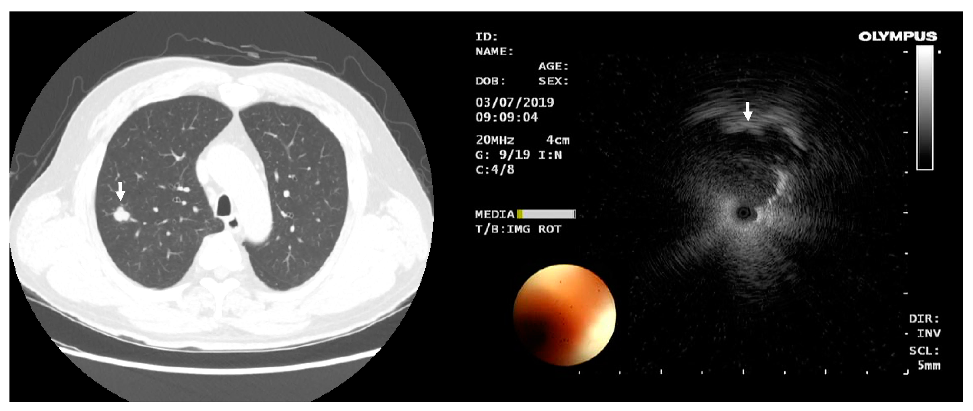 Medicina 58 01235 g001
