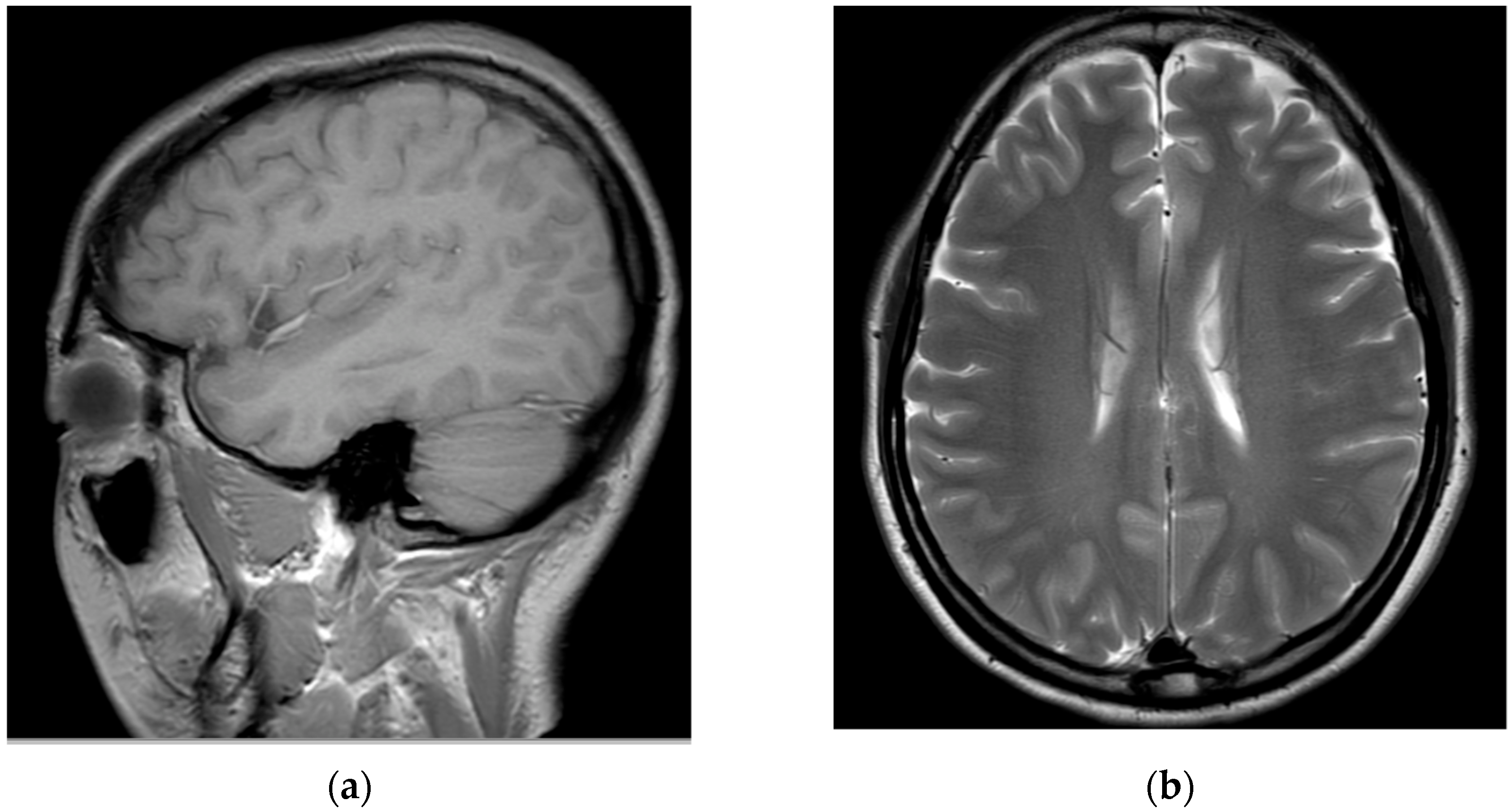 Medicina 58 01237 g002