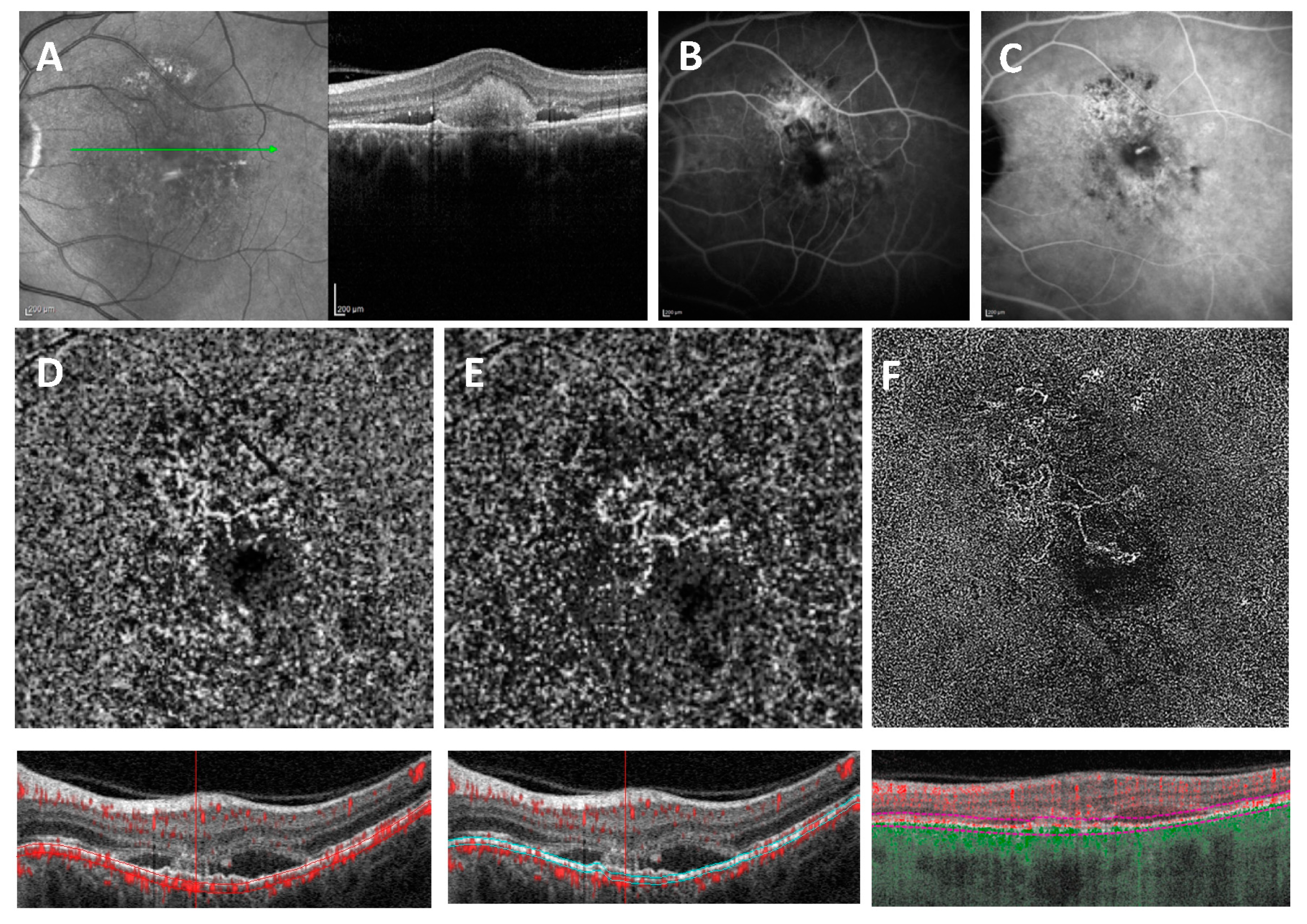 Medicina 58 01246 g004