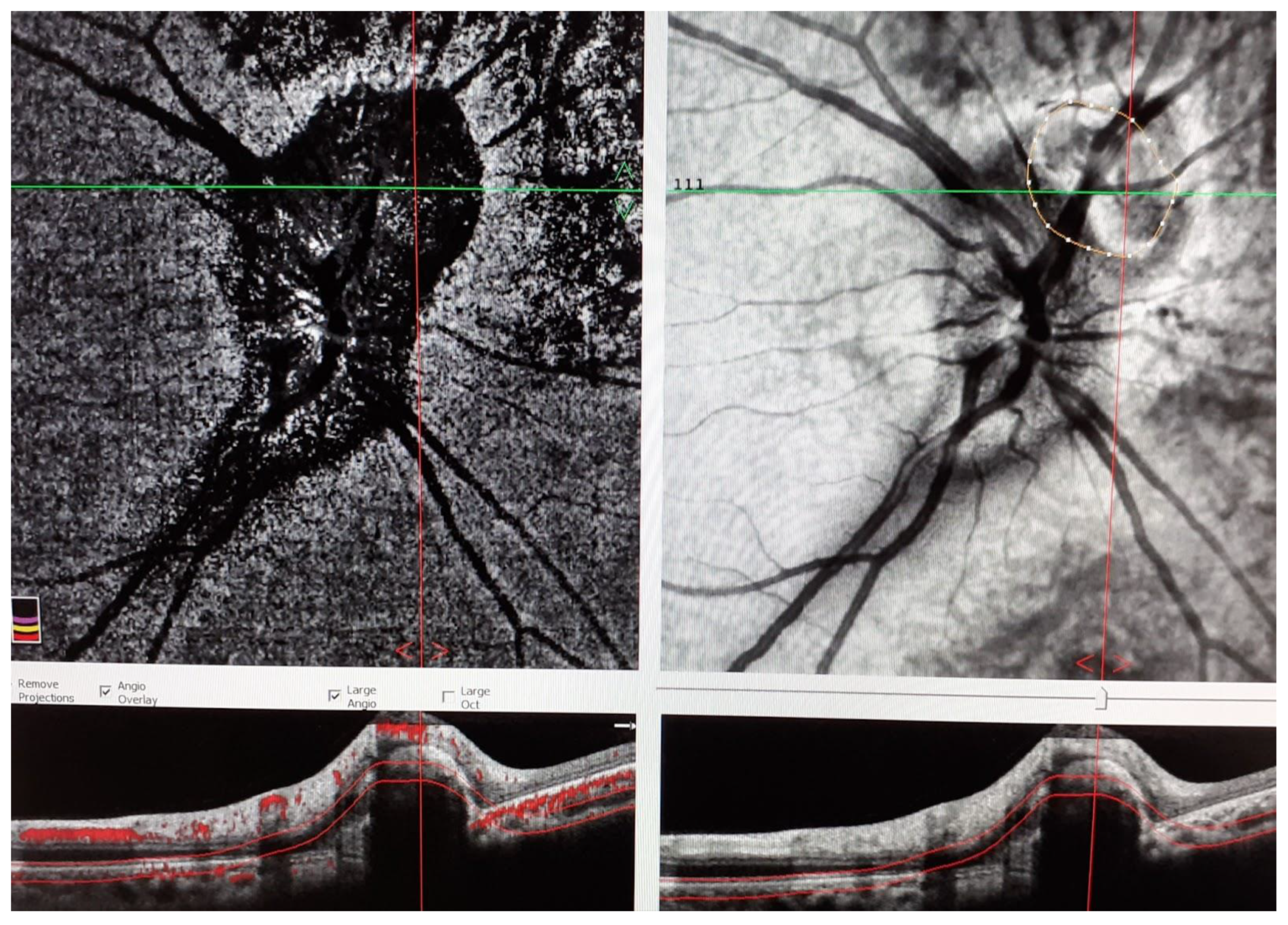 Medicina 58 01260 g004b